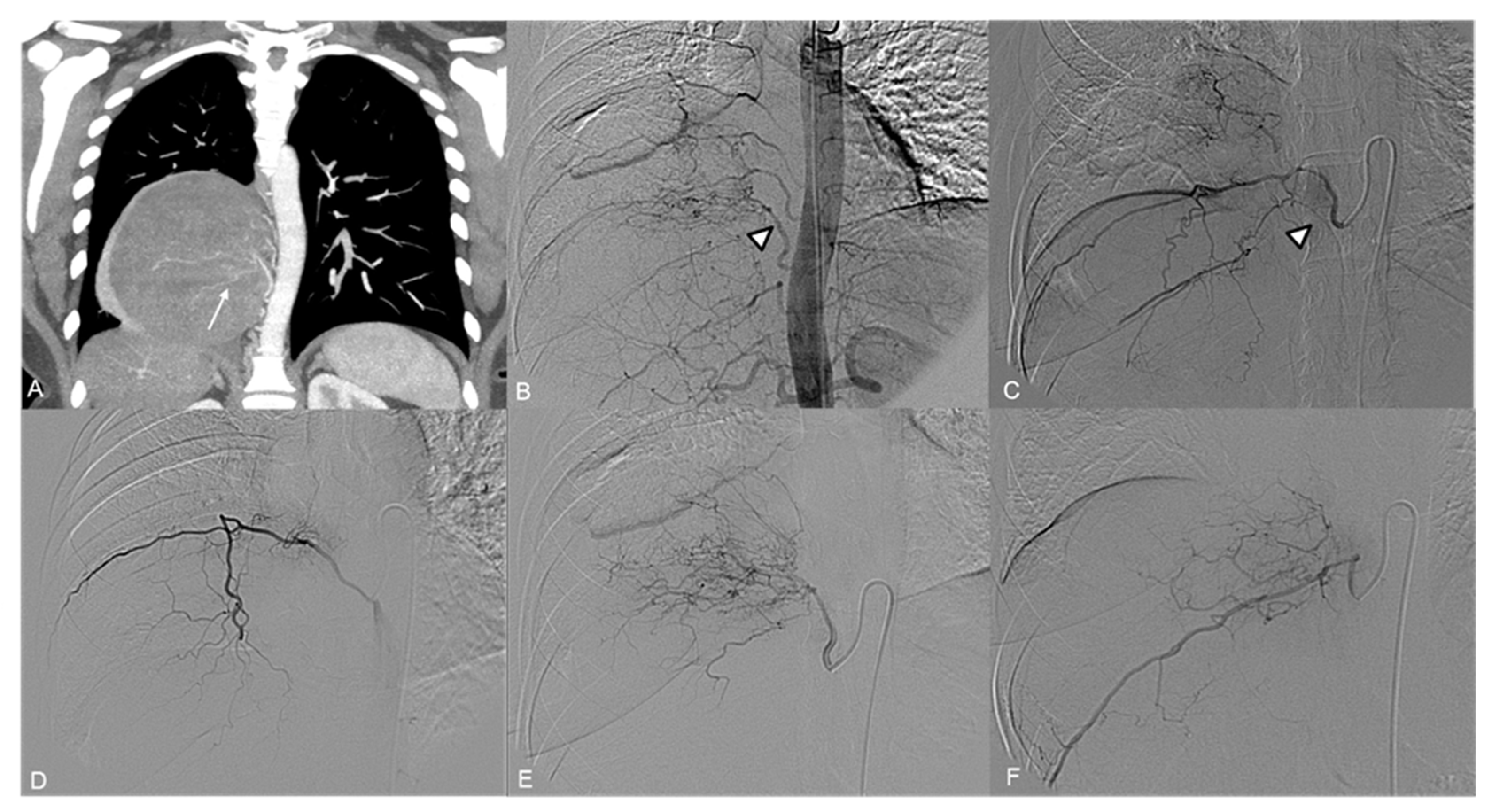 Jpm 14 01019 g001 Jpm 14 01019 g001