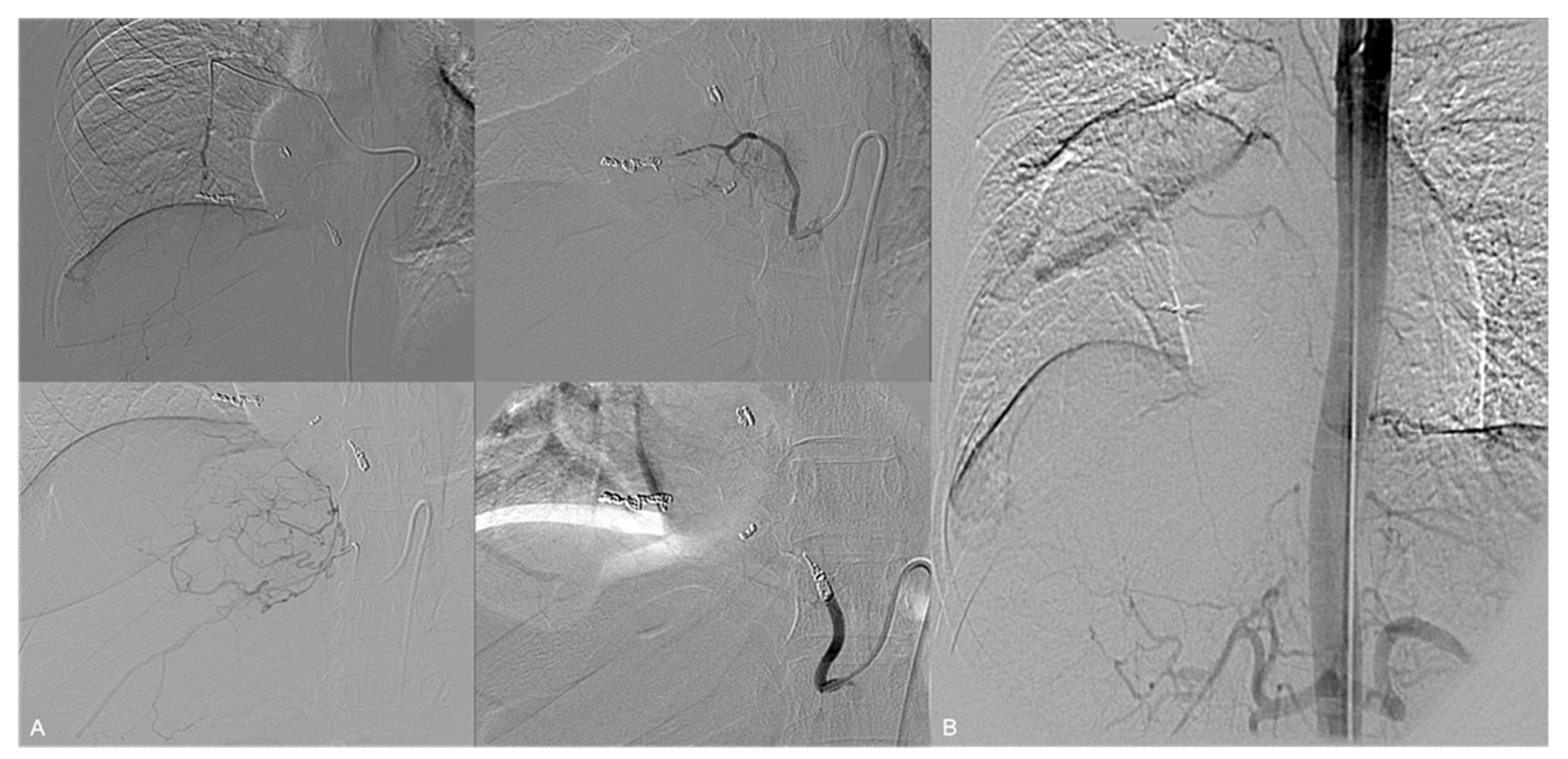 Jpm 14 01019 g002 Jpm 14 01019 g002