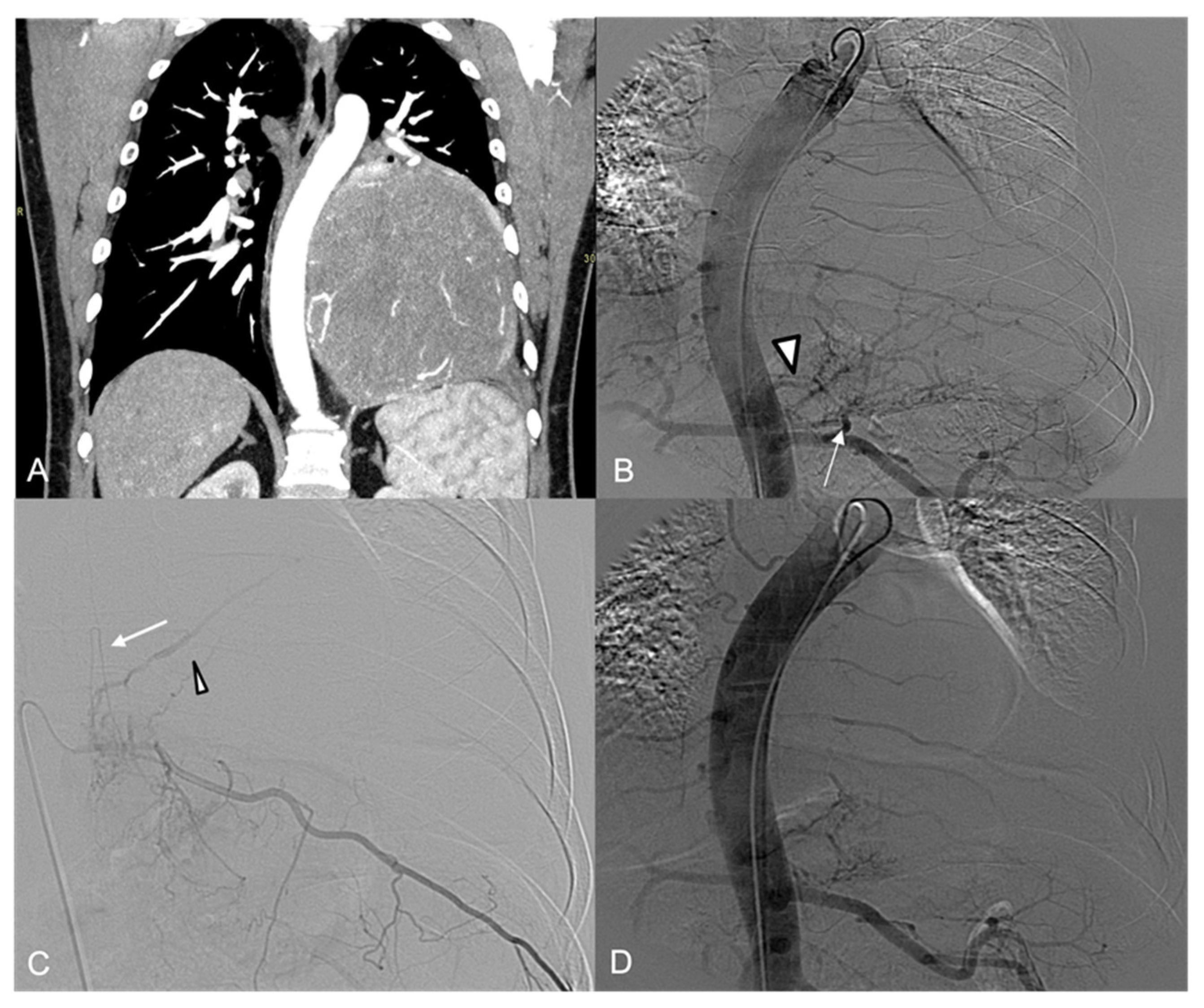 Jpm 14 01019 g005 Jpm 14 01019 g005