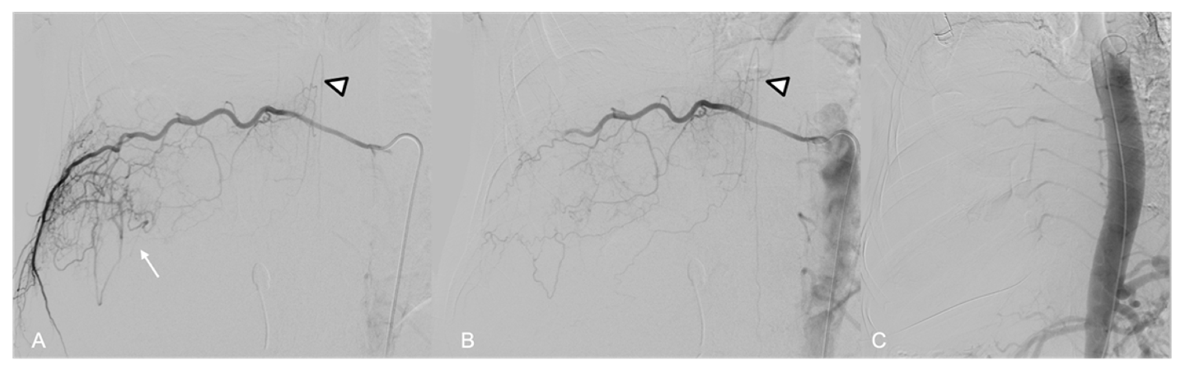 Jpm 14 01019 g008 Jpm 14 01019 g008
