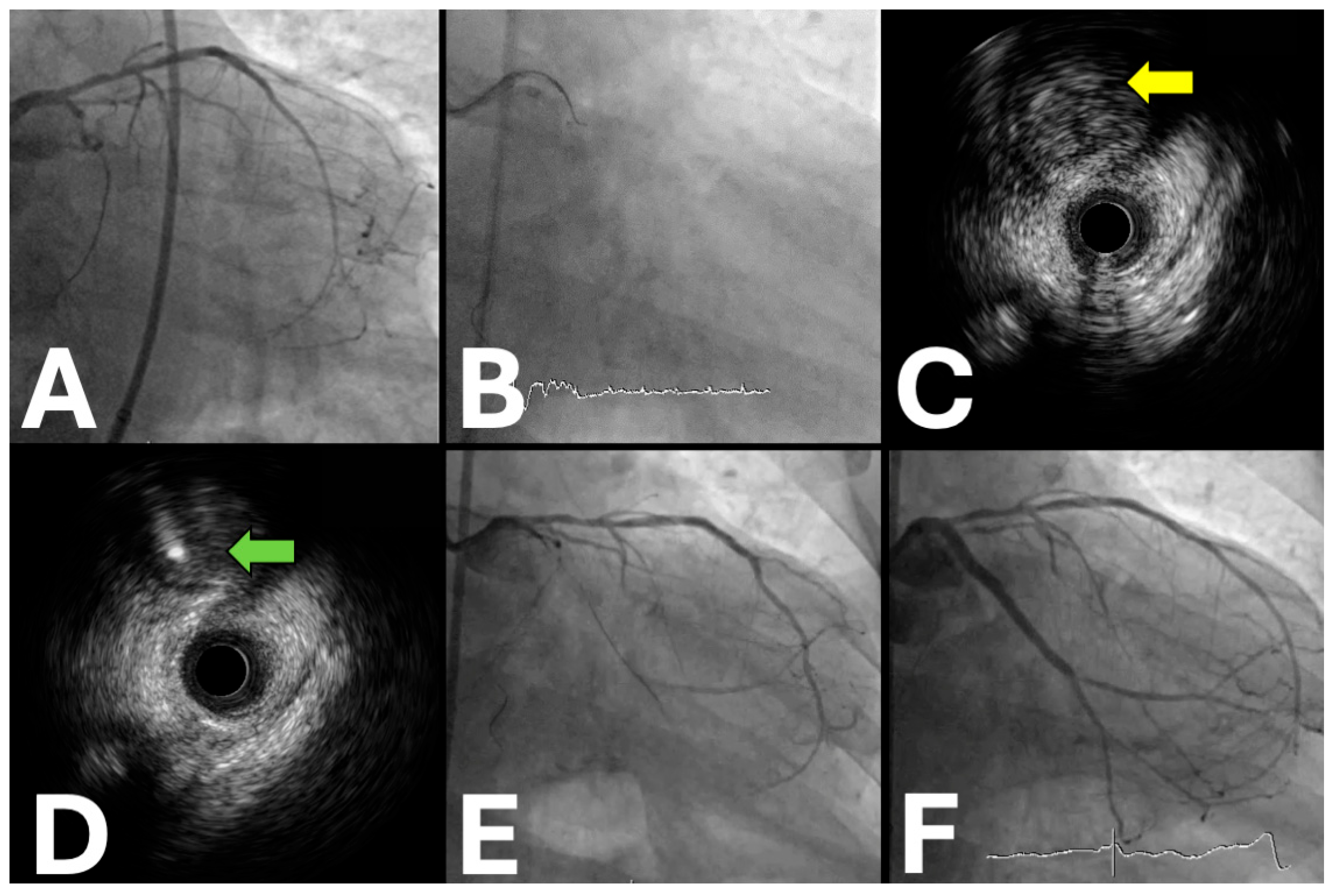 Jpm 15 00318 g001 Jpm 15 00318 g001