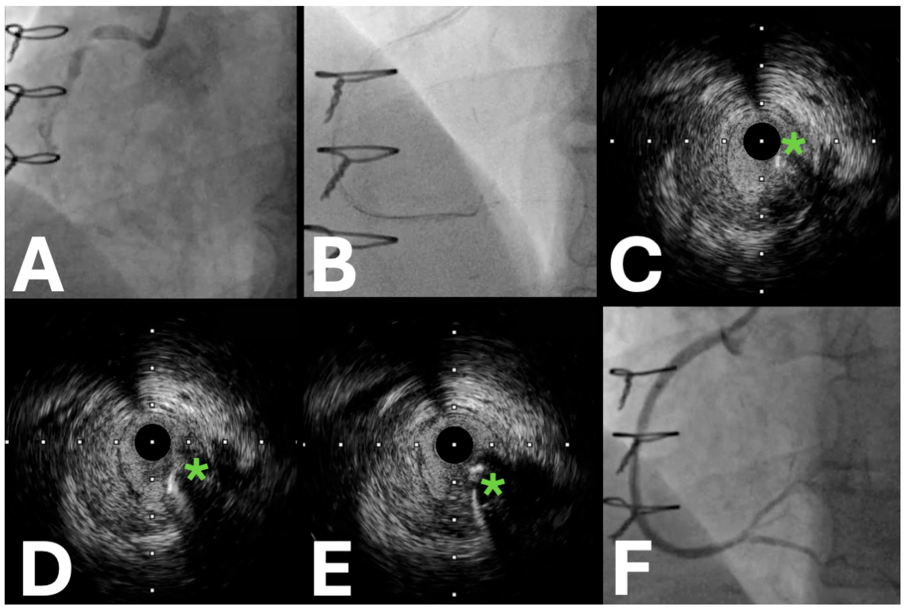 Jpm 15 00318 g003 Jpm 15 00318 g003