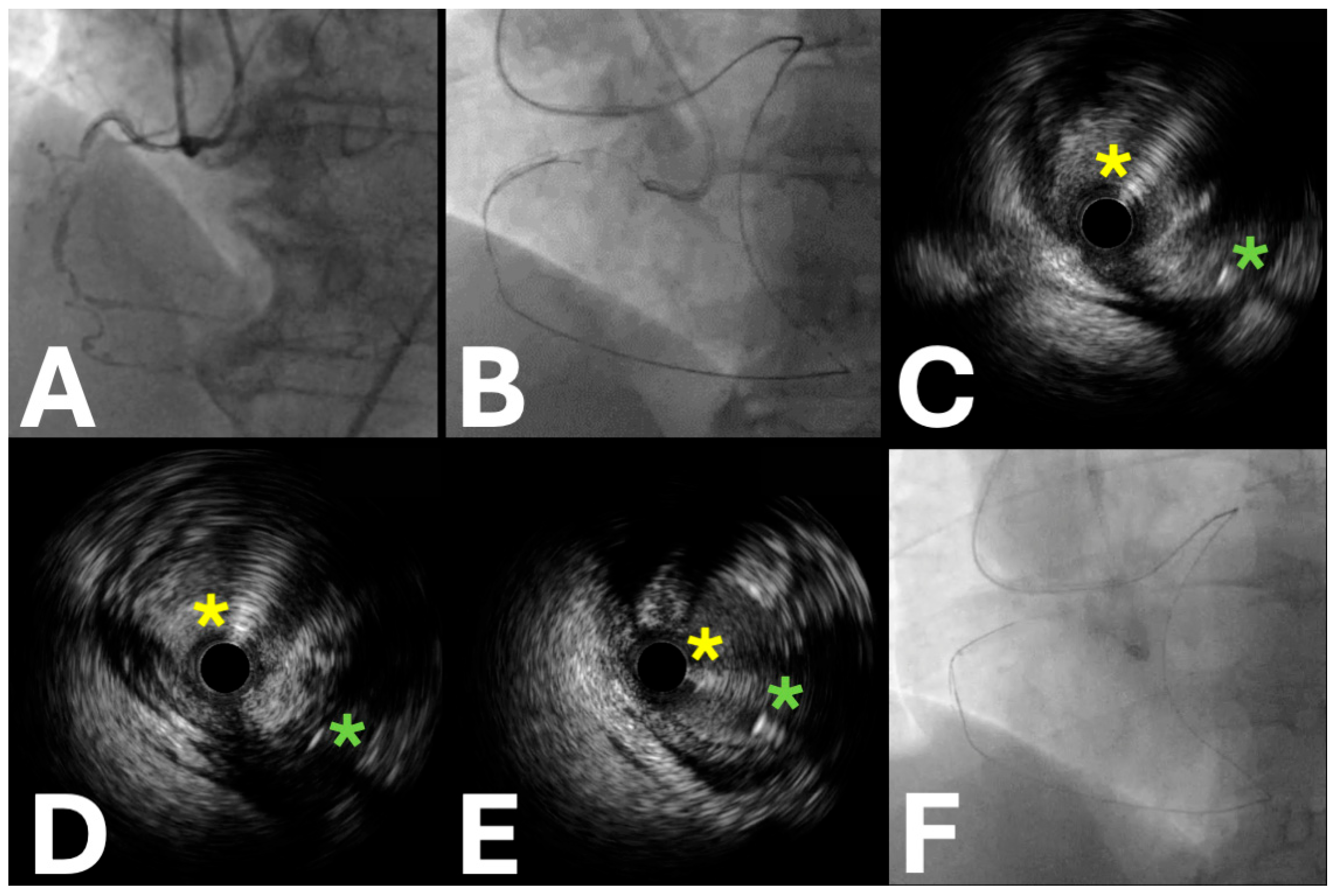 Jpm 15 00318 g004 Jpm 15 00318 g004