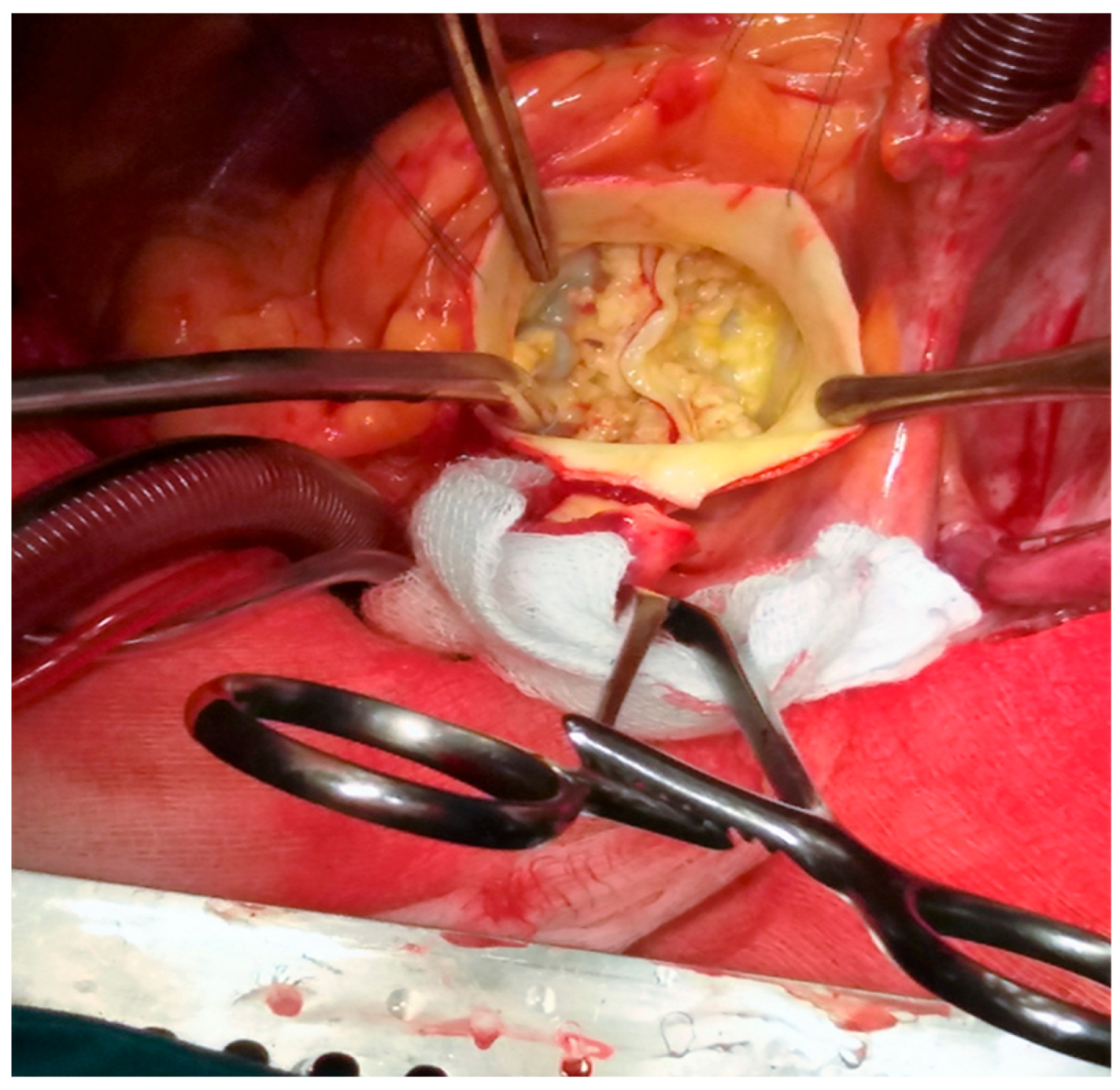 Jpm 15 00337 g001 Jpm 15 00337 g001