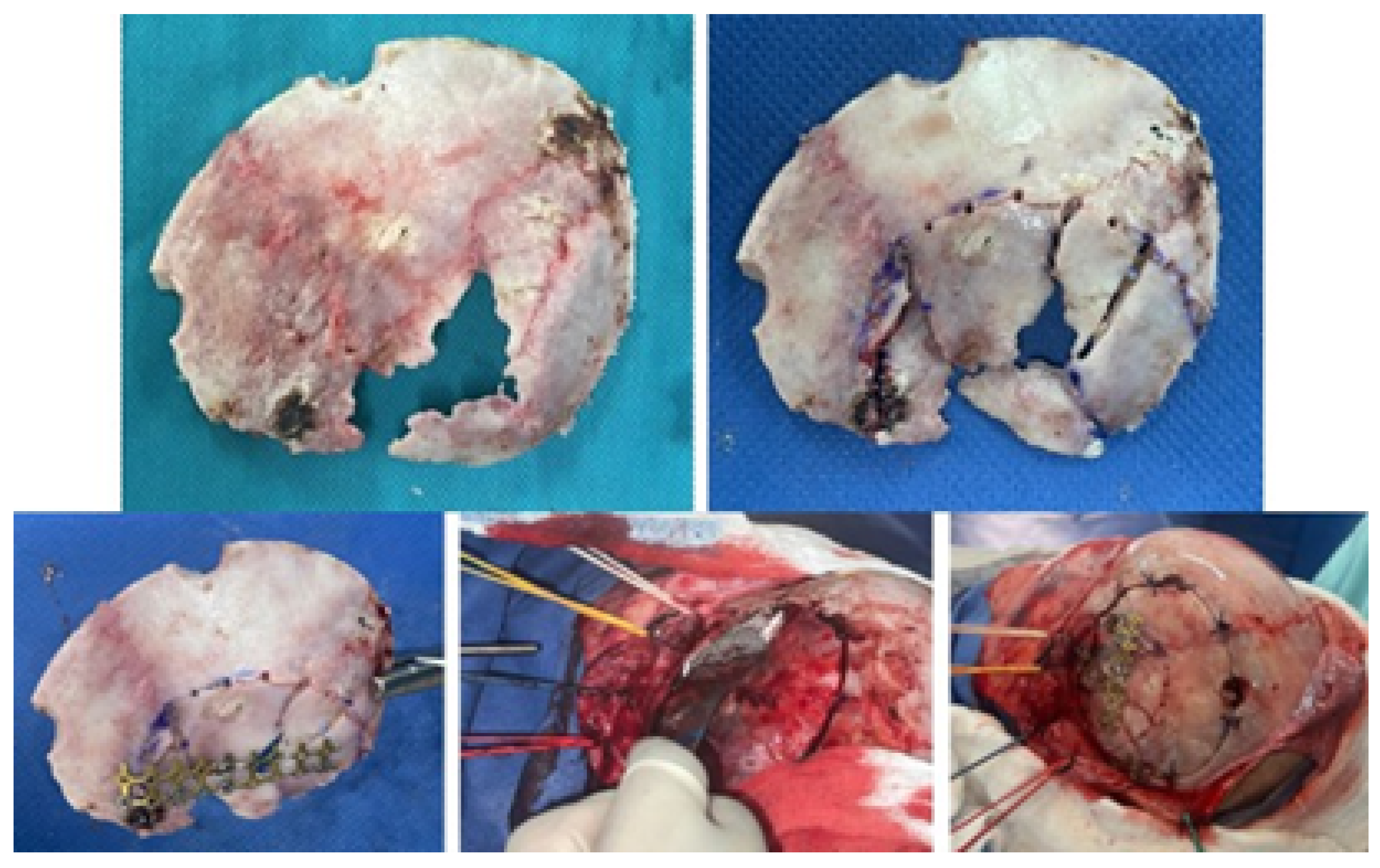 Jpm 15 00397 g007 Jpm 15 00397 g007