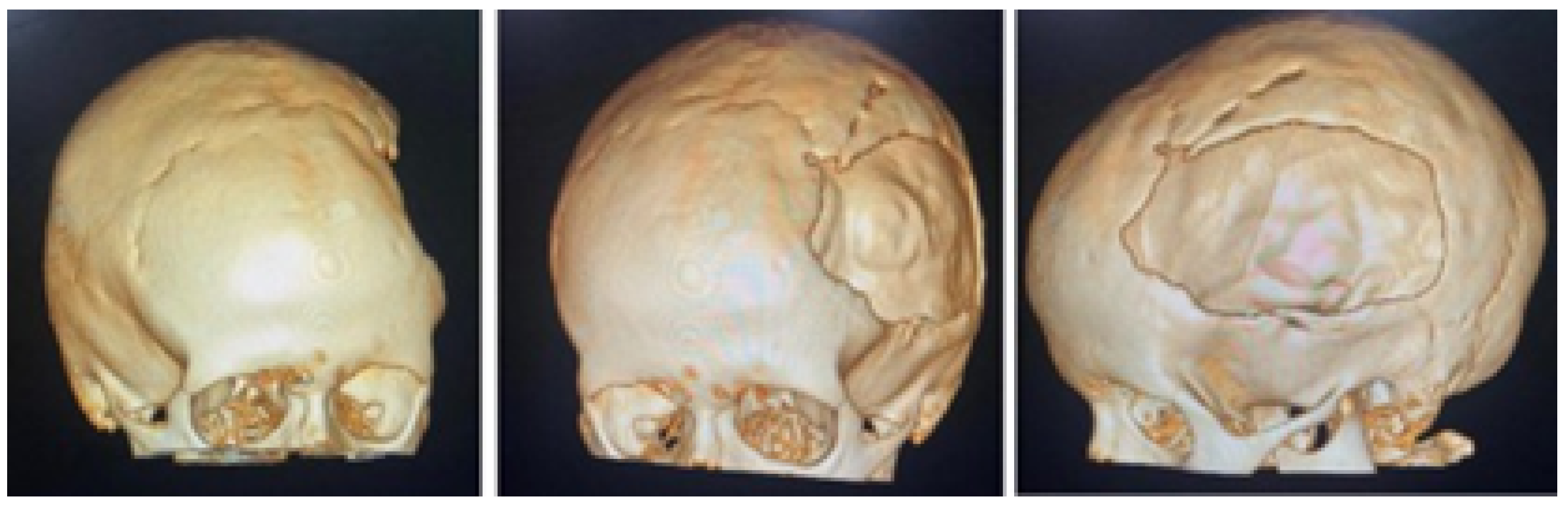 Jpm 15 00397 g011 Jpm 15 00397 g011