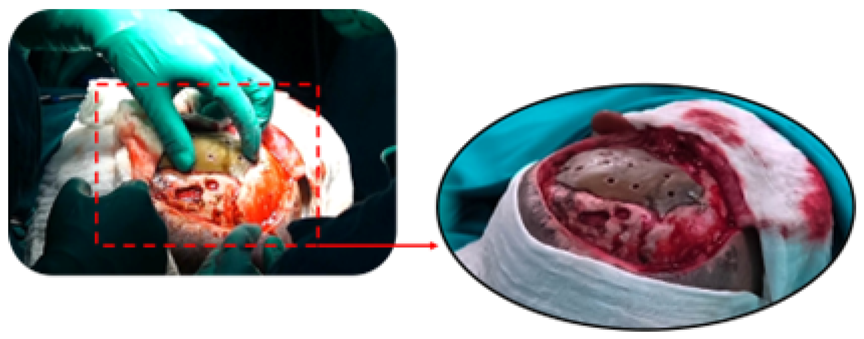 Jpm 15 00397 g014 Jpm 15 00397 g014