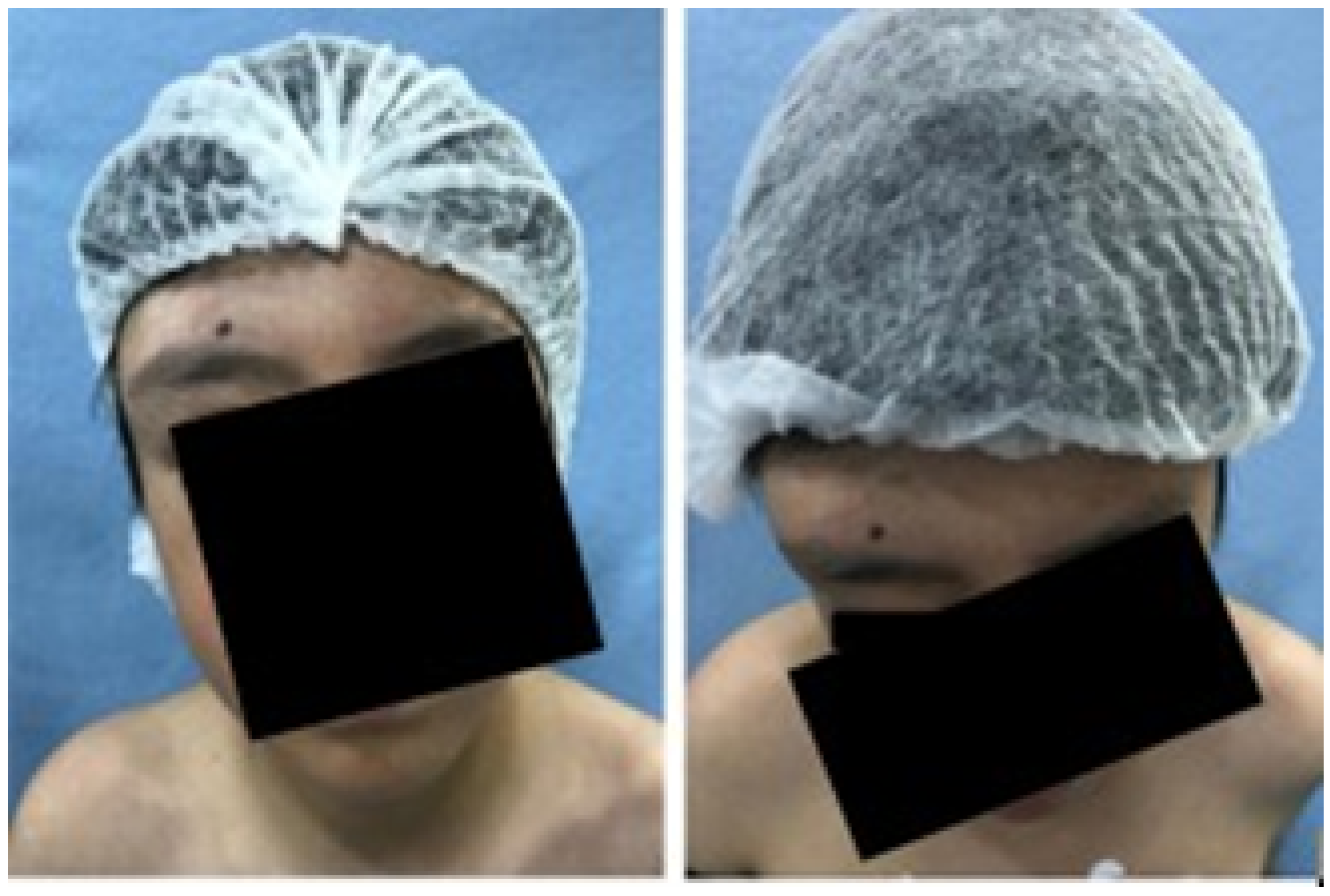 Jpm 15 00397 g017 Jpm 15 00397 g017