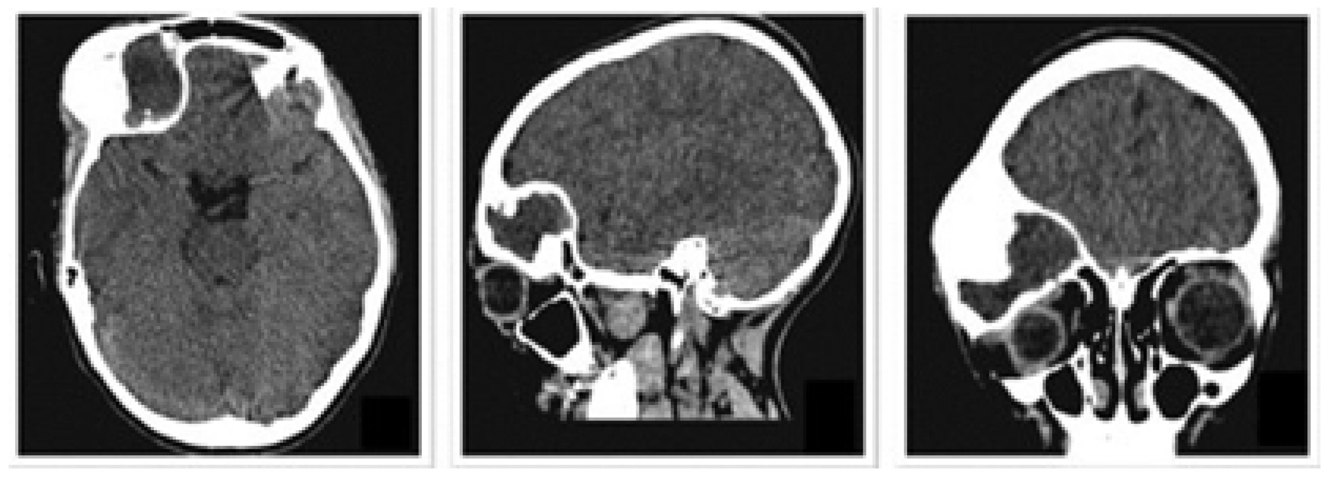 Jpm 15 00397 g018 Jpm 15 00397 g018