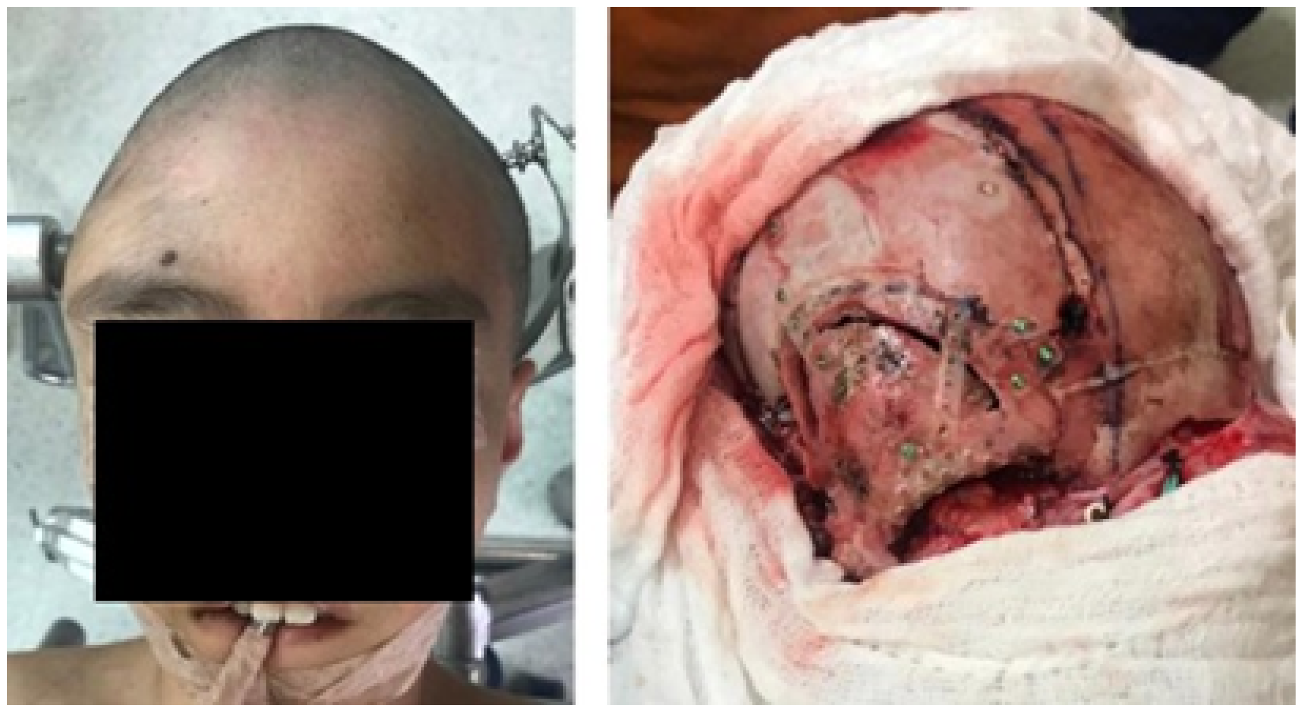 Jpm 15 00397 g021 Jpm 15 00397 g021