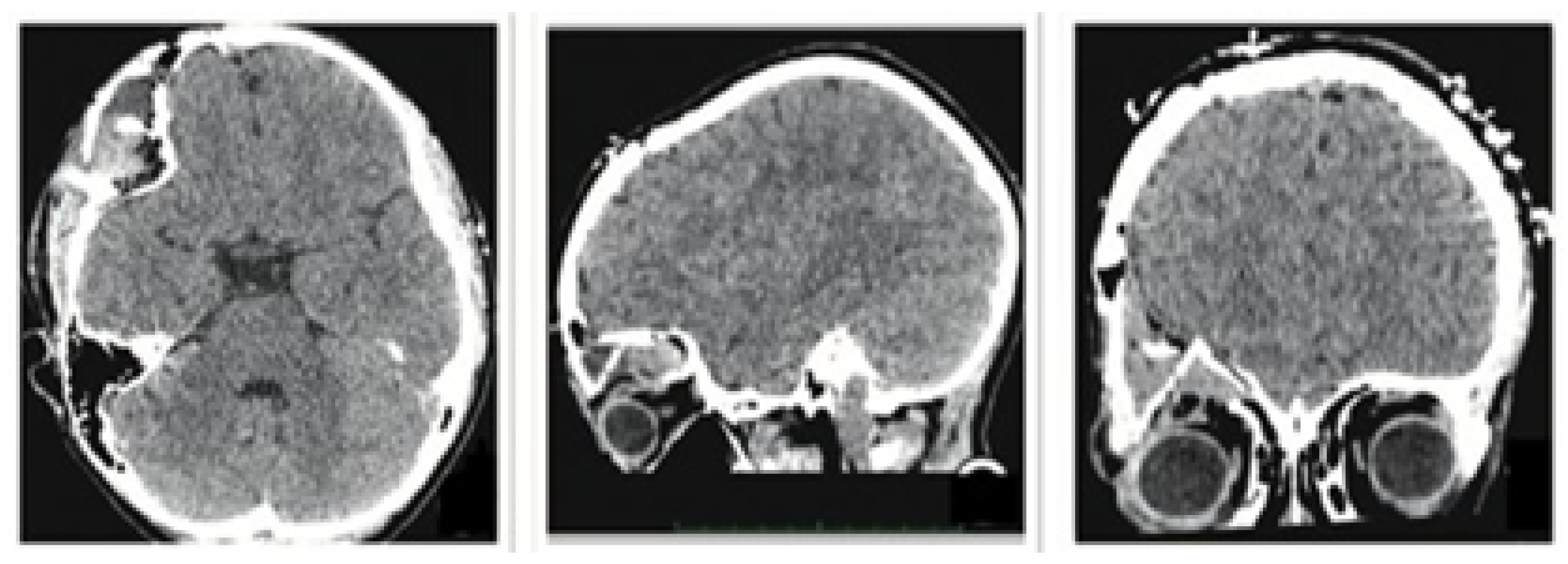 Jpm 15 00397 g022 Jpm 15 00397 g022