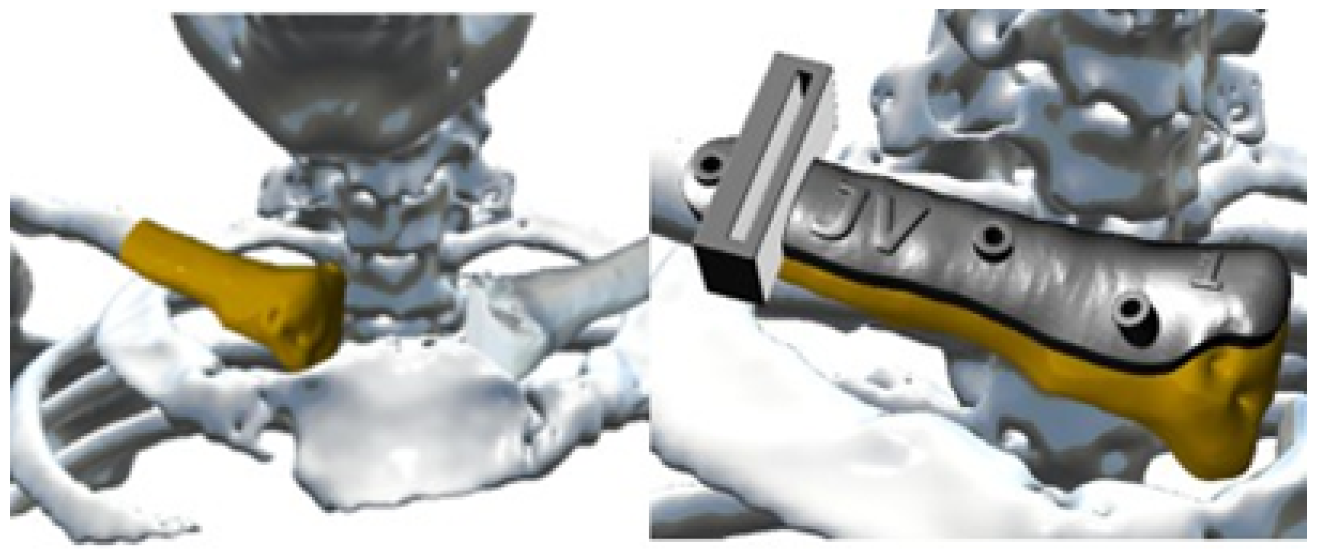 Jpm 15 00397 g025 Jpm 15 00397 g025