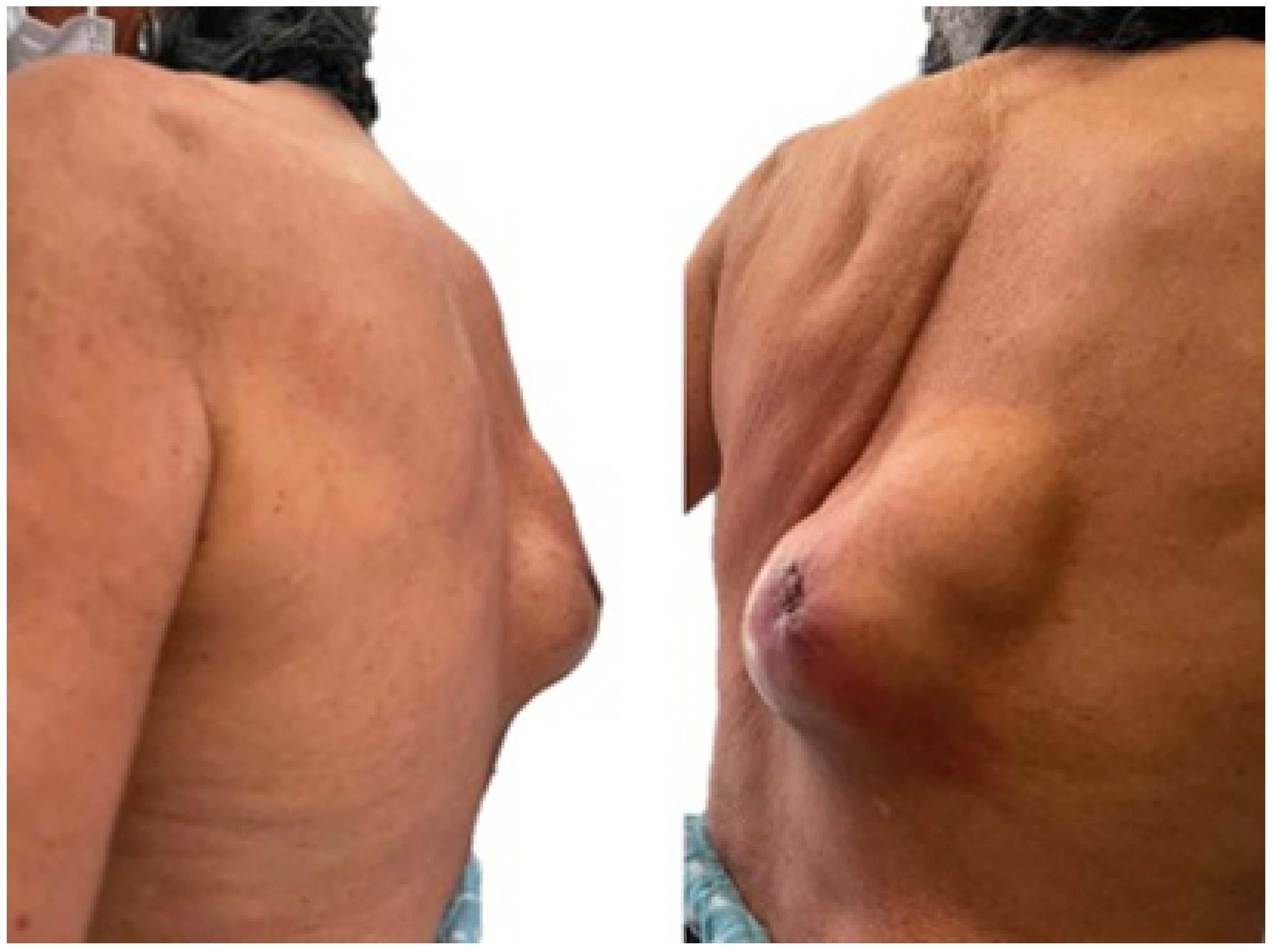 Jpm 15 00397 g032 Jpm 15 00397 g032