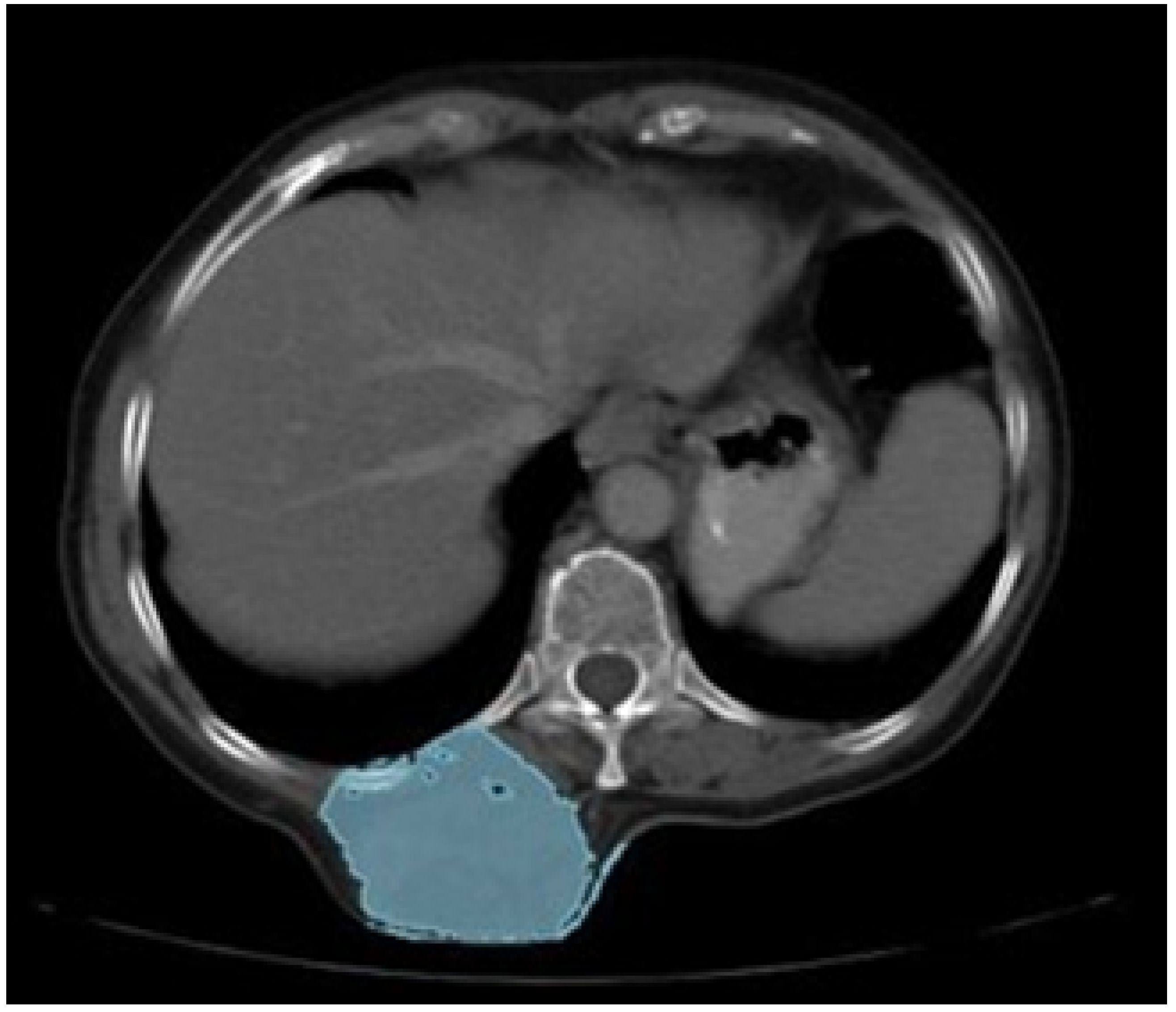 Jpm 15 00397 g033 Jpm 15 00397 g033