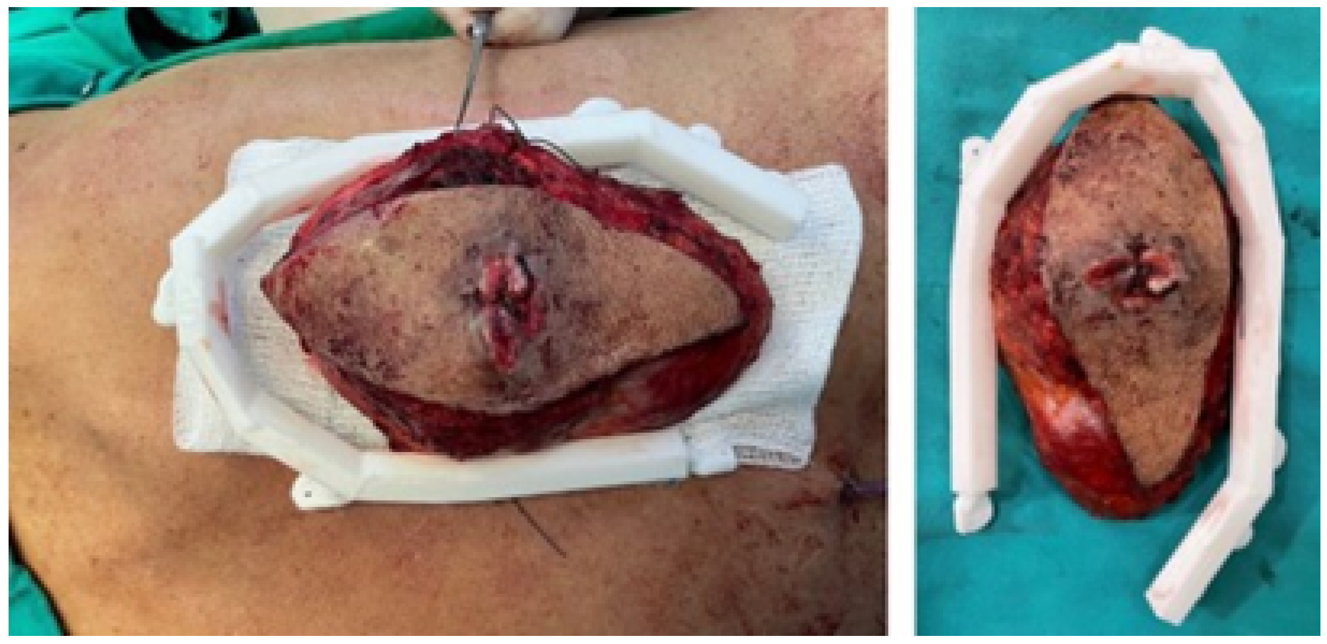 Jpm 15 00397 g036 Jpm 15 00397 g036