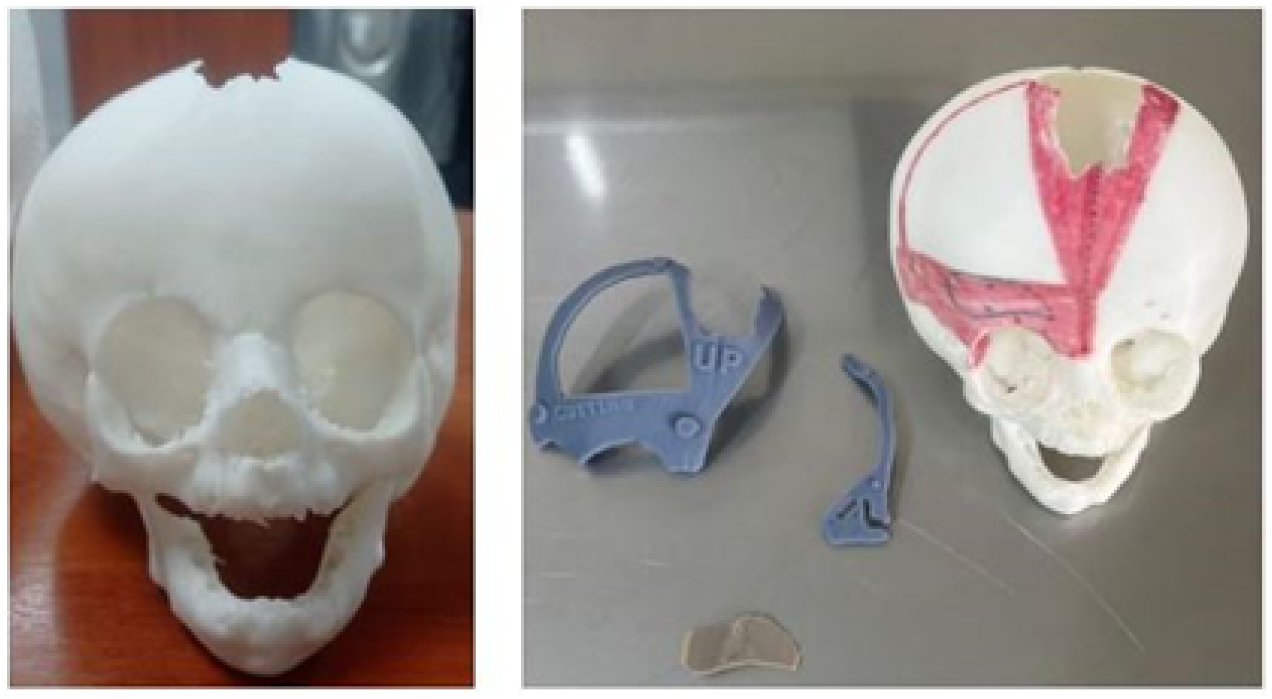 Jpm 15 00397 g044 Jpm 15 00397 g044