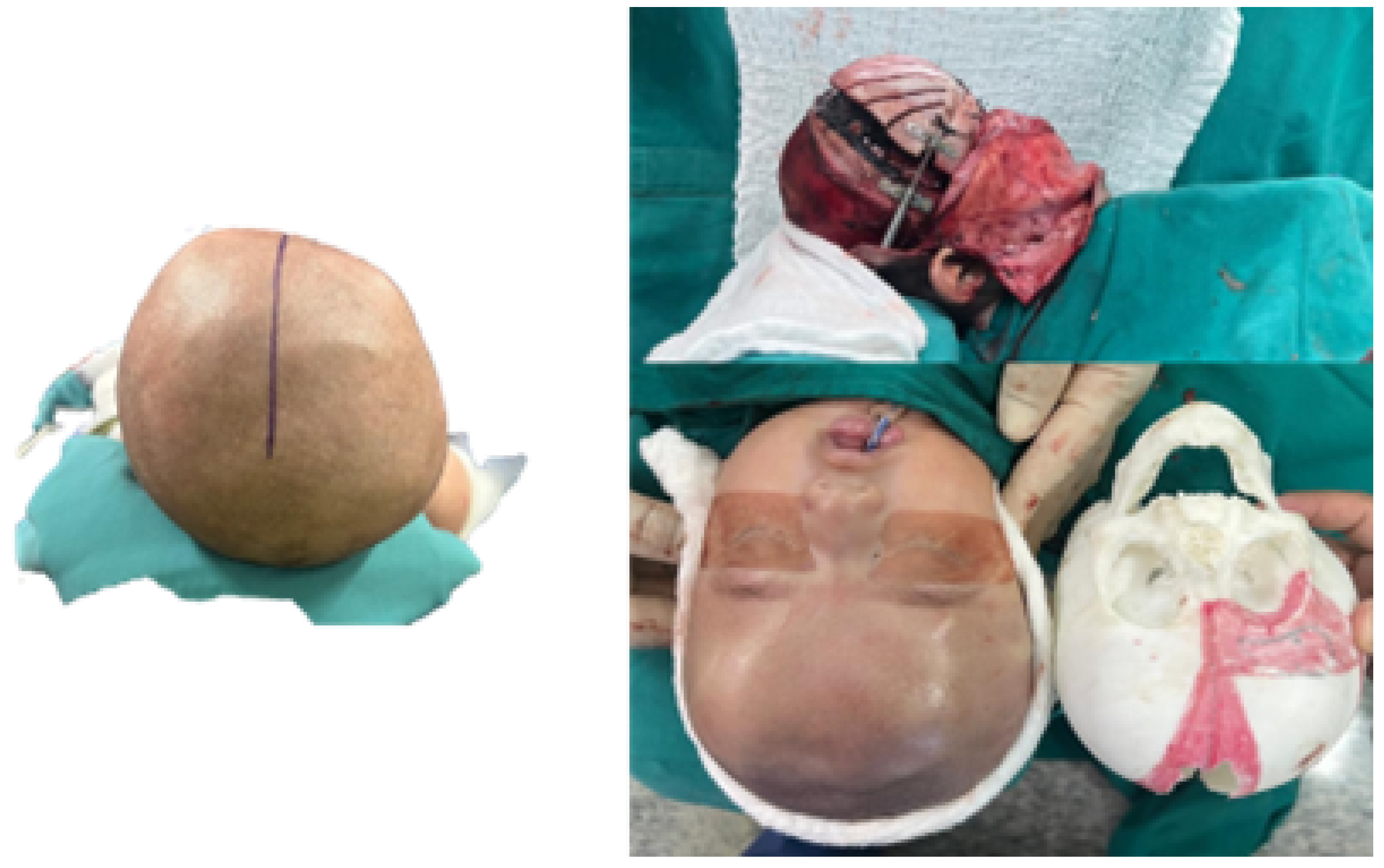 Jpm 15 00397 g046 Jpm 15 00397 g046