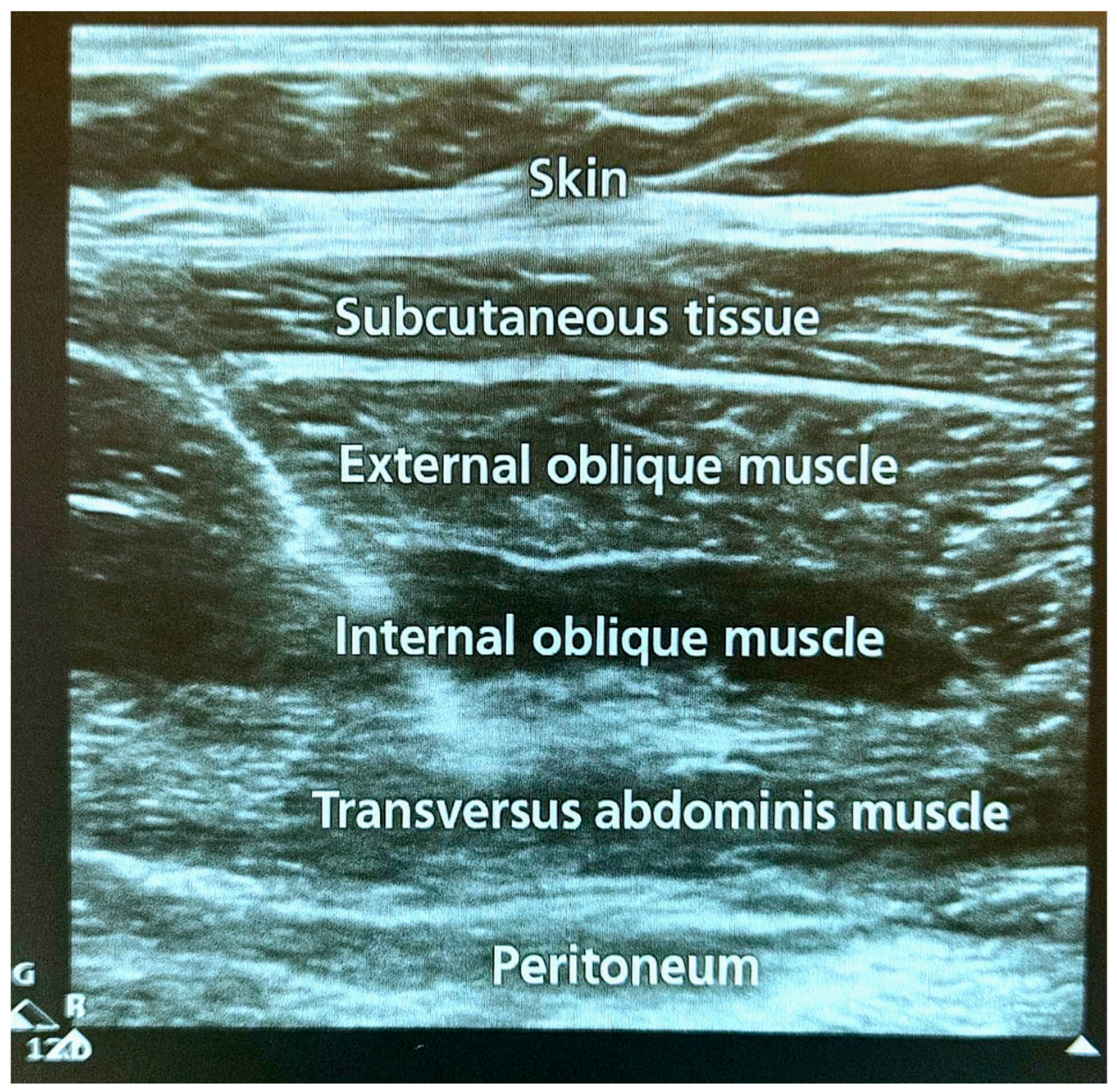 Jpm 15 00411 g001 Jpm 15 00411 g001