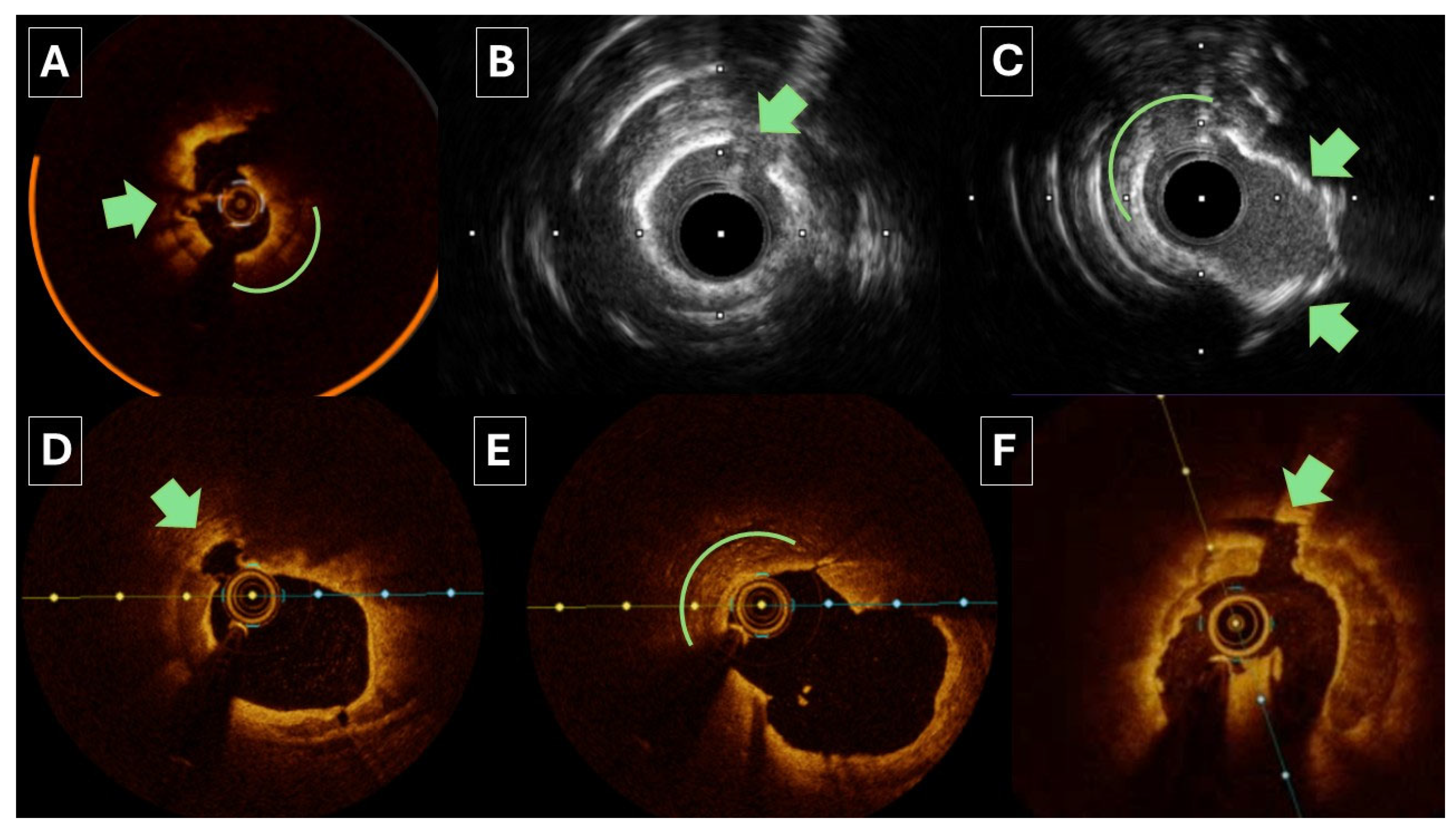 Jpm 15 00414 g001 Jpm 15 00414 g001