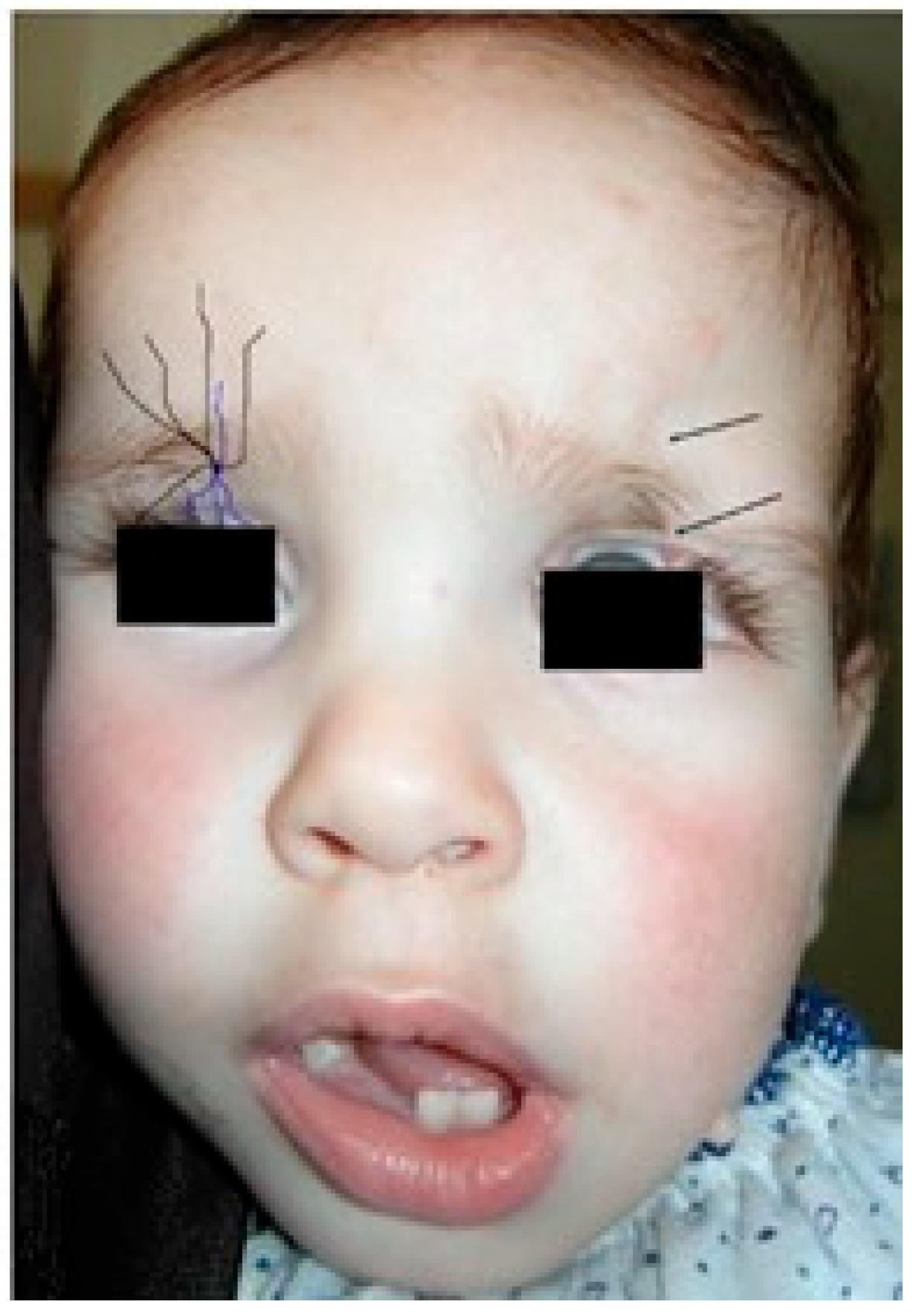 Jpm 15 00556 g004 Jpm 15 00556 g004