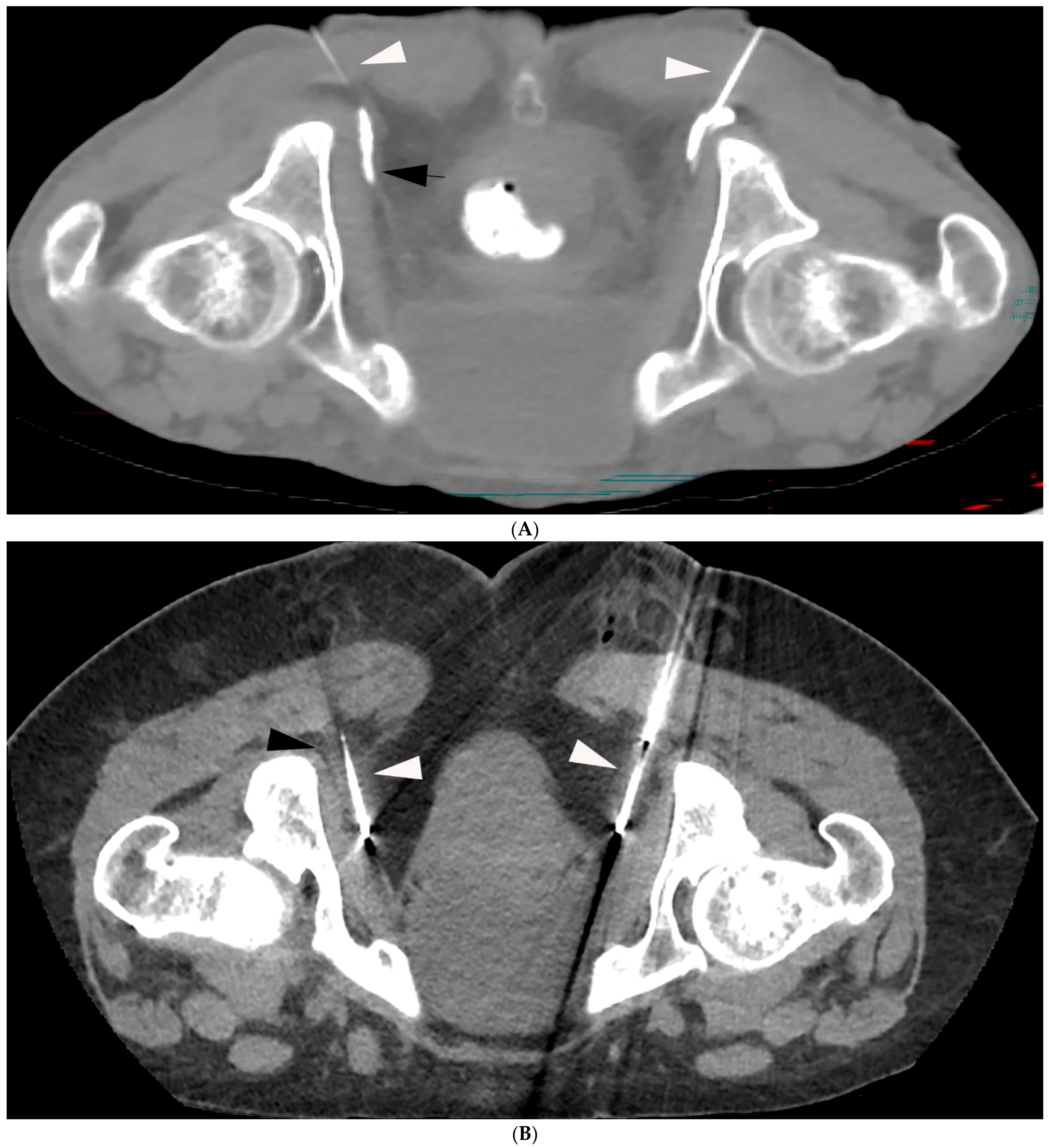 Jpm 15 00587 g001 Jpm 15 00587 g001