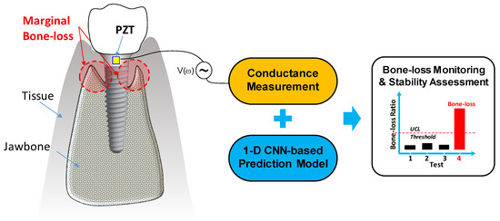 A Proof-of-Concept Study of Stability Monitoring of Implant