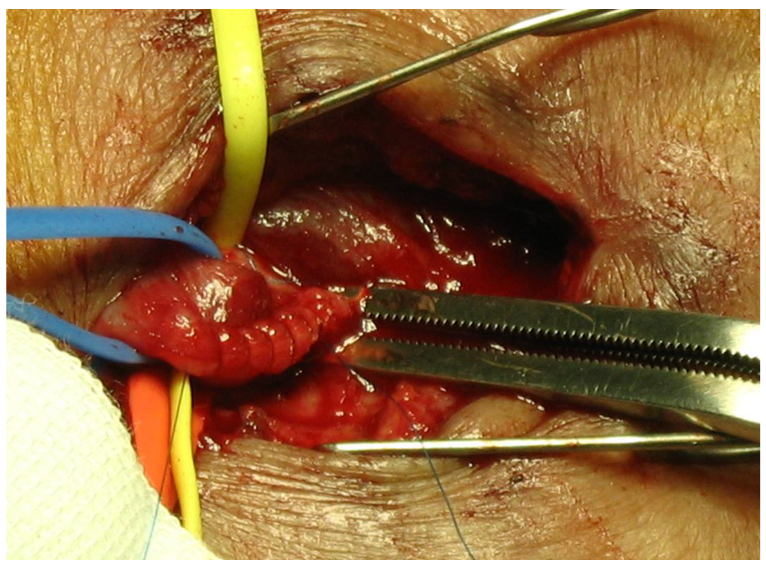 Kidneydial 01 00007 g003 Kidneydial 01 00007 g003
