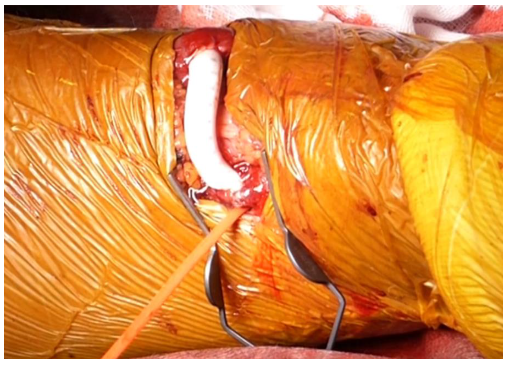 Kidneydial 01 00007 g004 Kidneydial 01 00007 g004