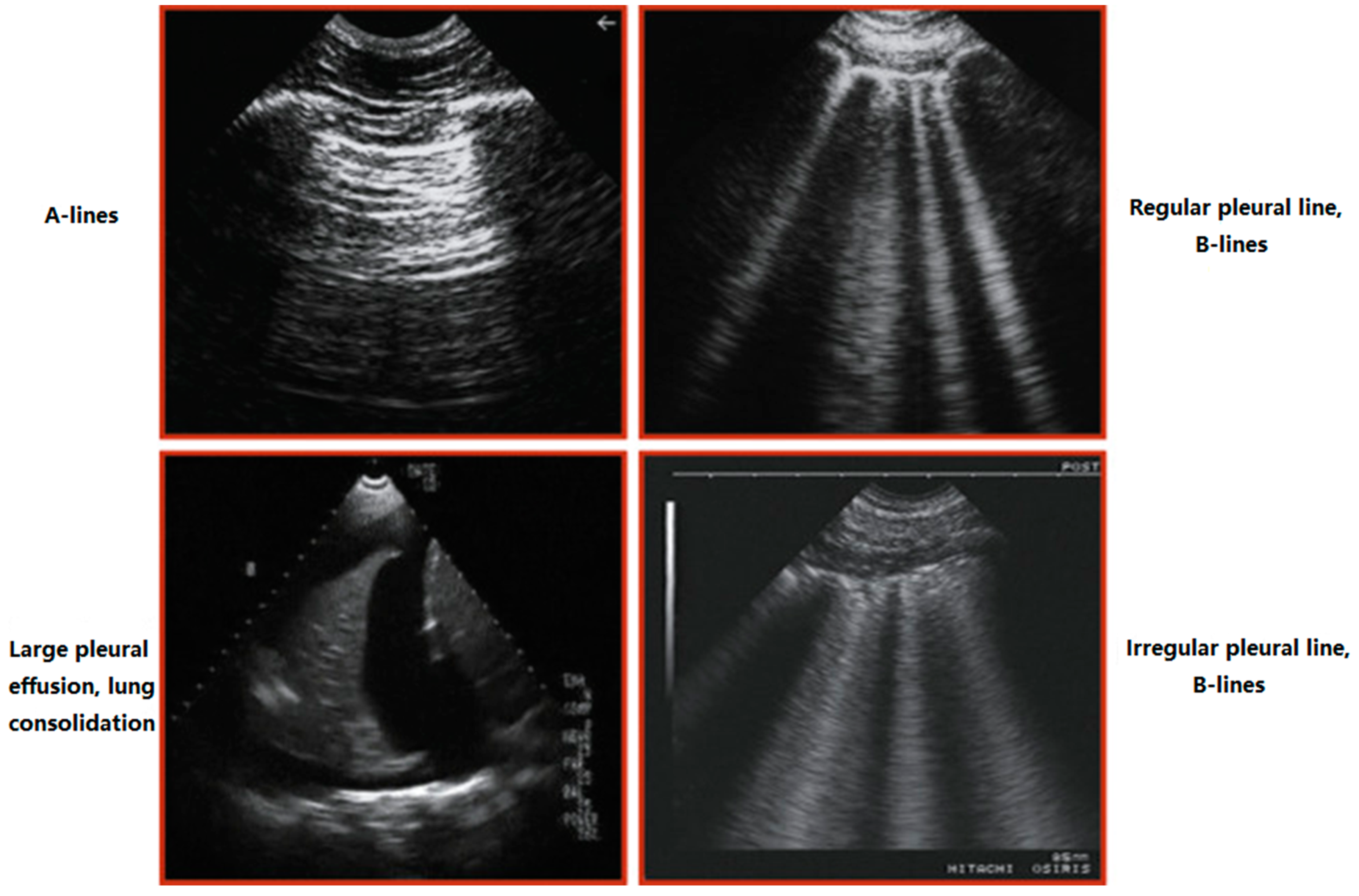 Kidneydial 02 00017 g002