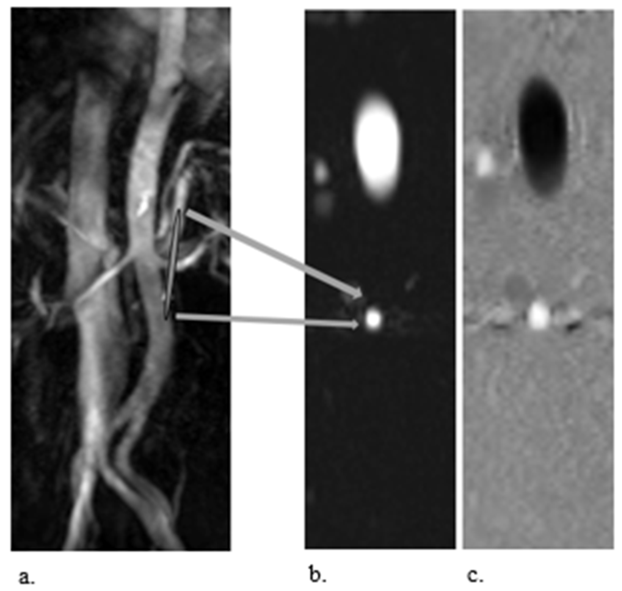Kidneydial 02 00036 g002 Kidneydial 02 00036 g002