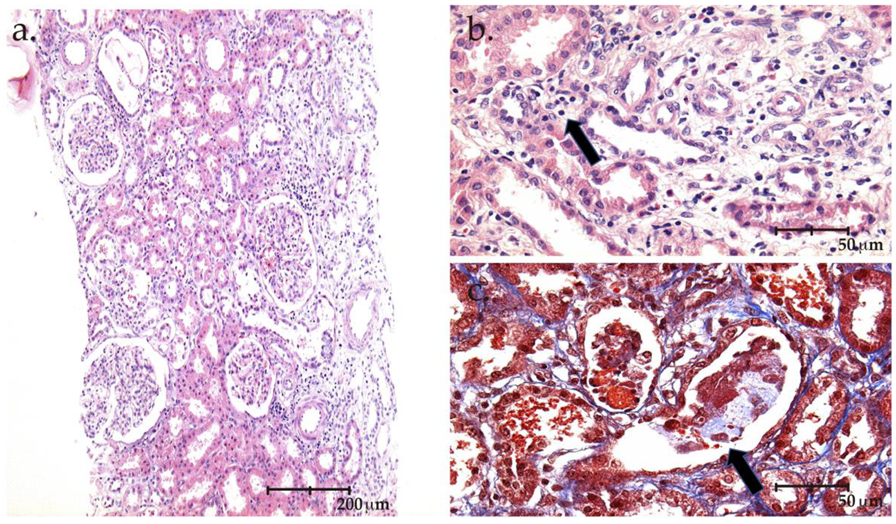 Kidneydial 02 00053 g001 Kidneydial 02 00053 g001