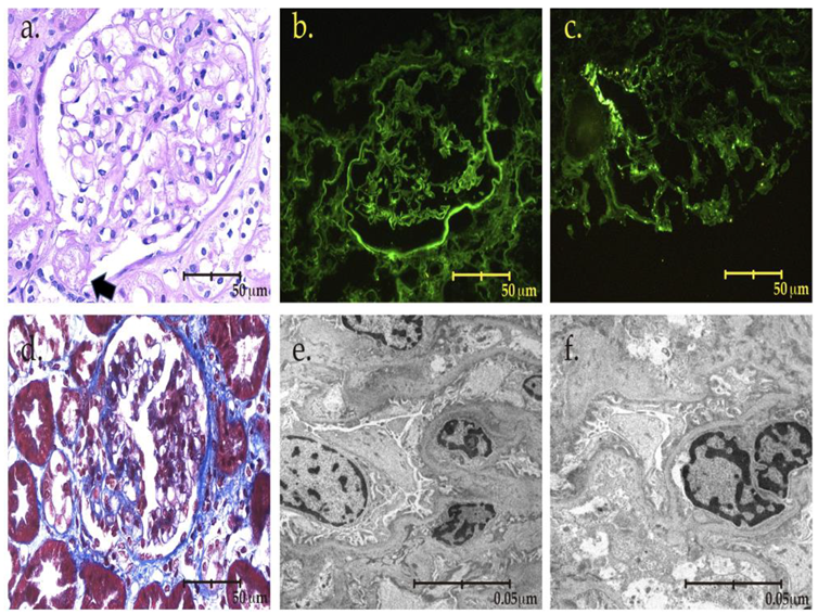Kidneydial 02 00053 g002 Kidneydial 02 00053 g002