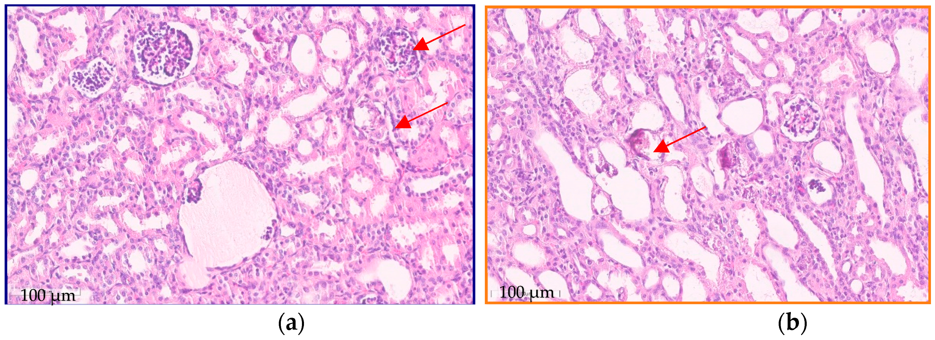 Kidneydial 03 00018 g001 Kidneydial 03 00018 g001