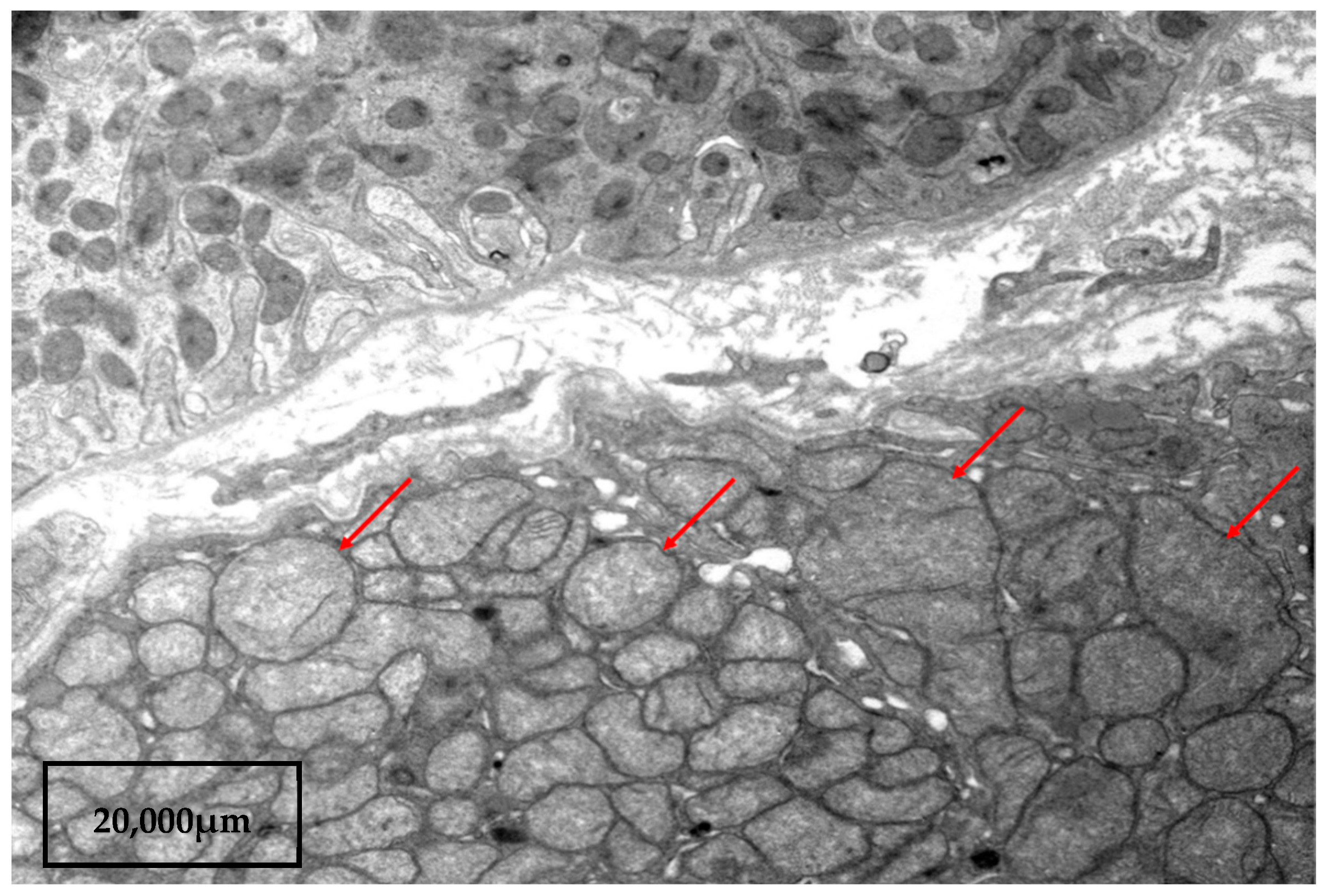 Kidneydial 03 00018 g002 Kidneydial 03 00018 g002