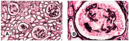 Kidneydial 03 00030 g003
