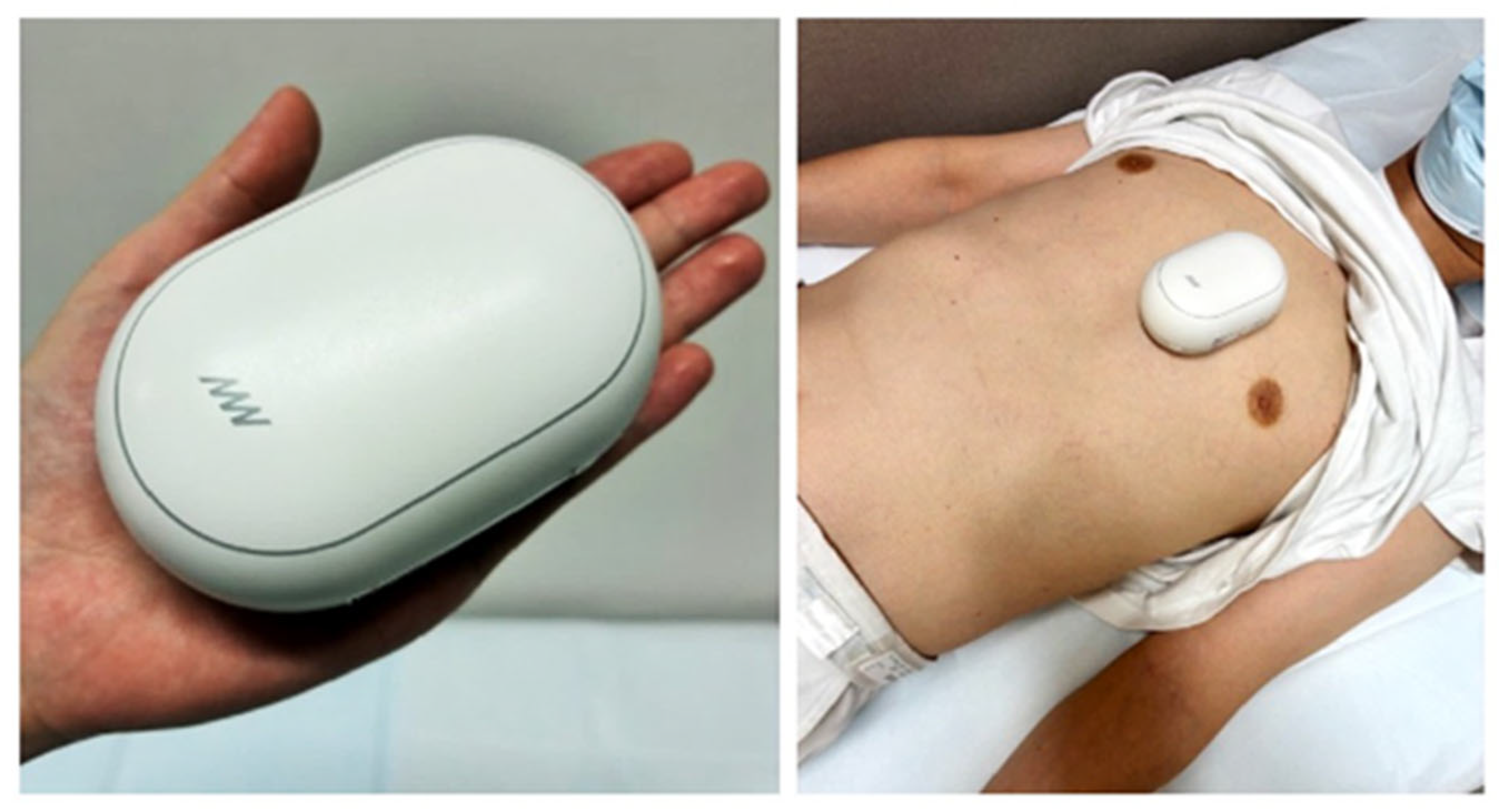 Kidneydial 06 00004 g001 Kidneydial 06 00004 g001