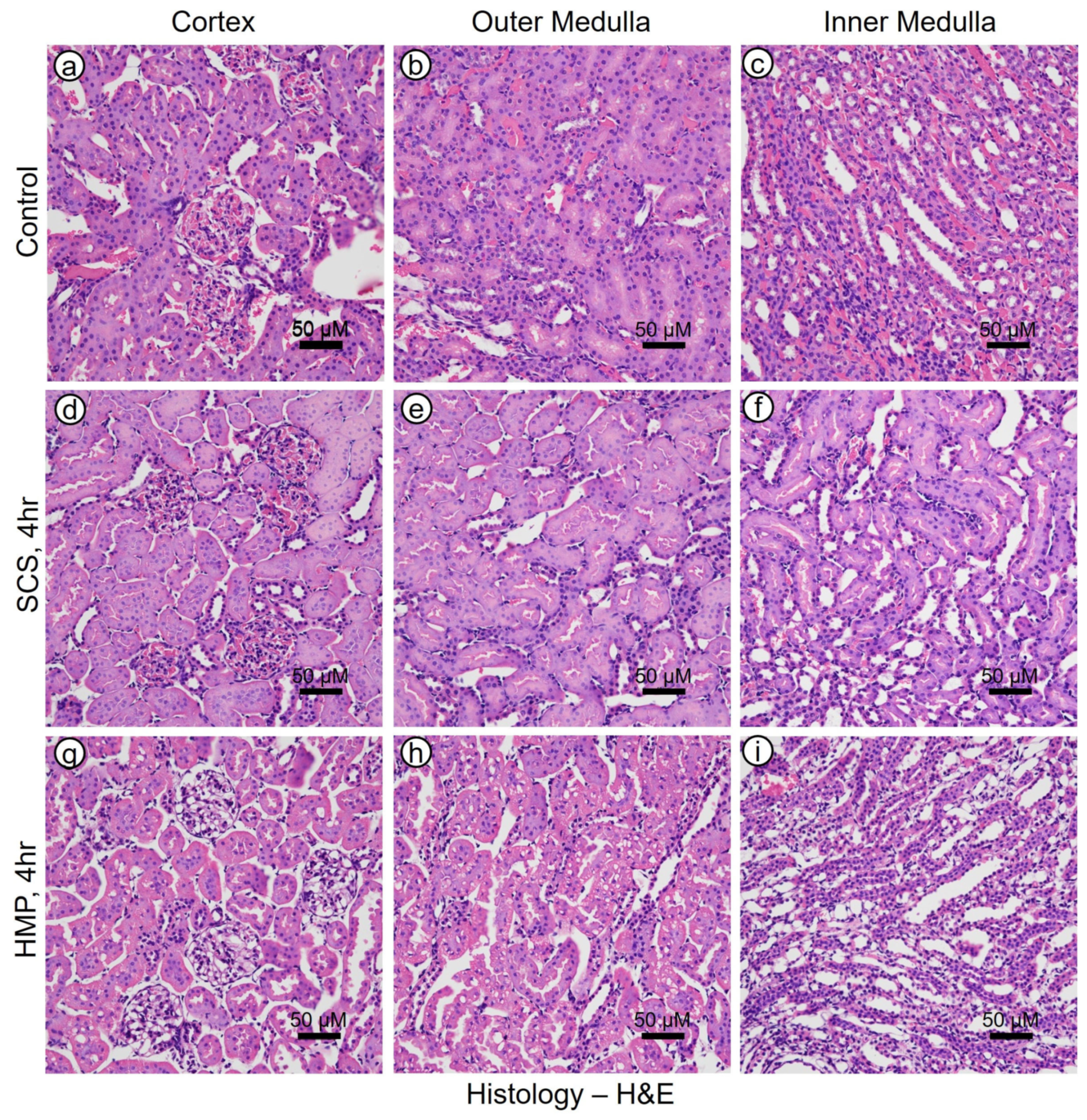 Kidneydial 06 00023 g006 Kidneydial 06 00023 g006