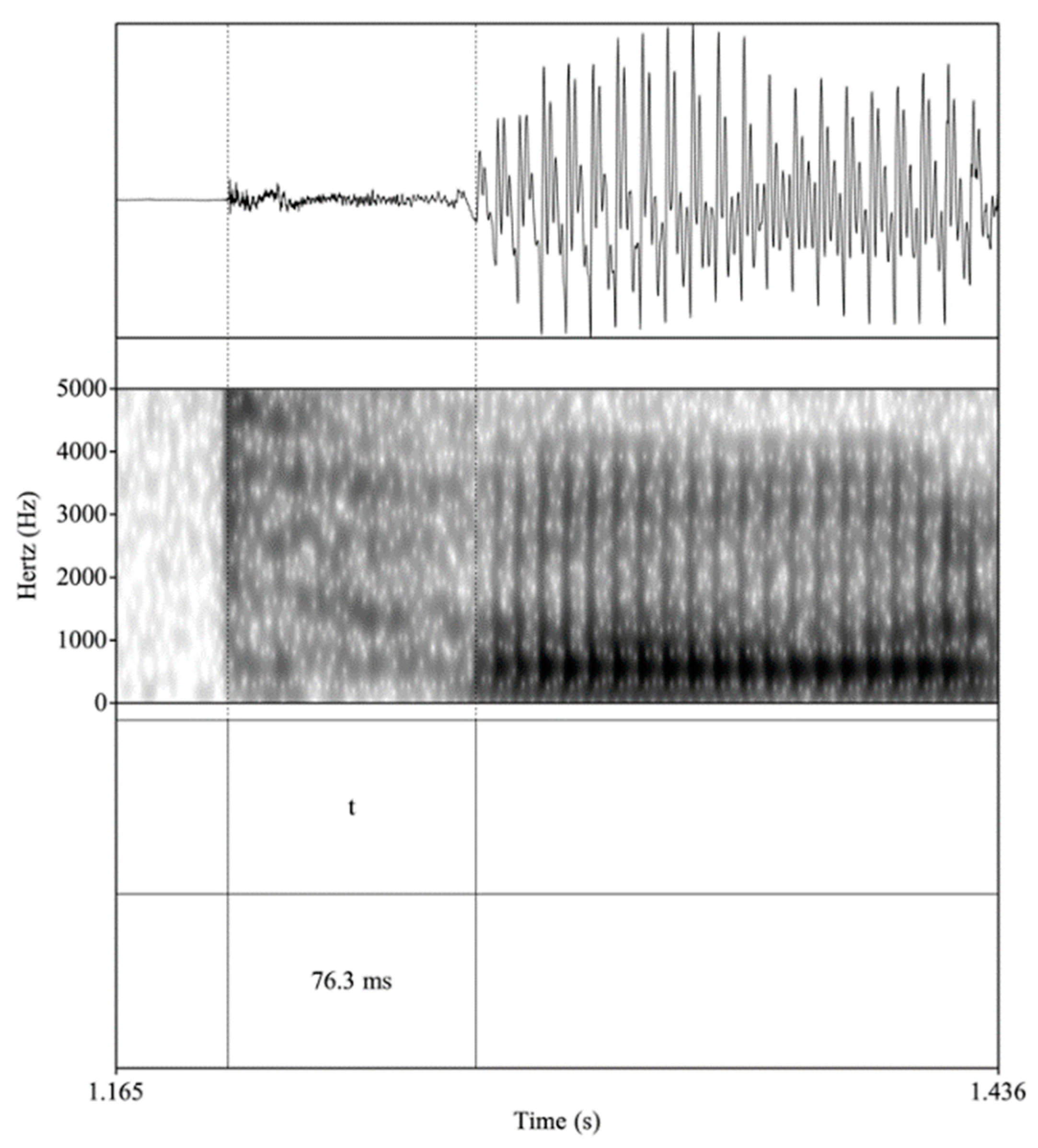 Languages 05 00072 g002 Languages 05 00072 g002
