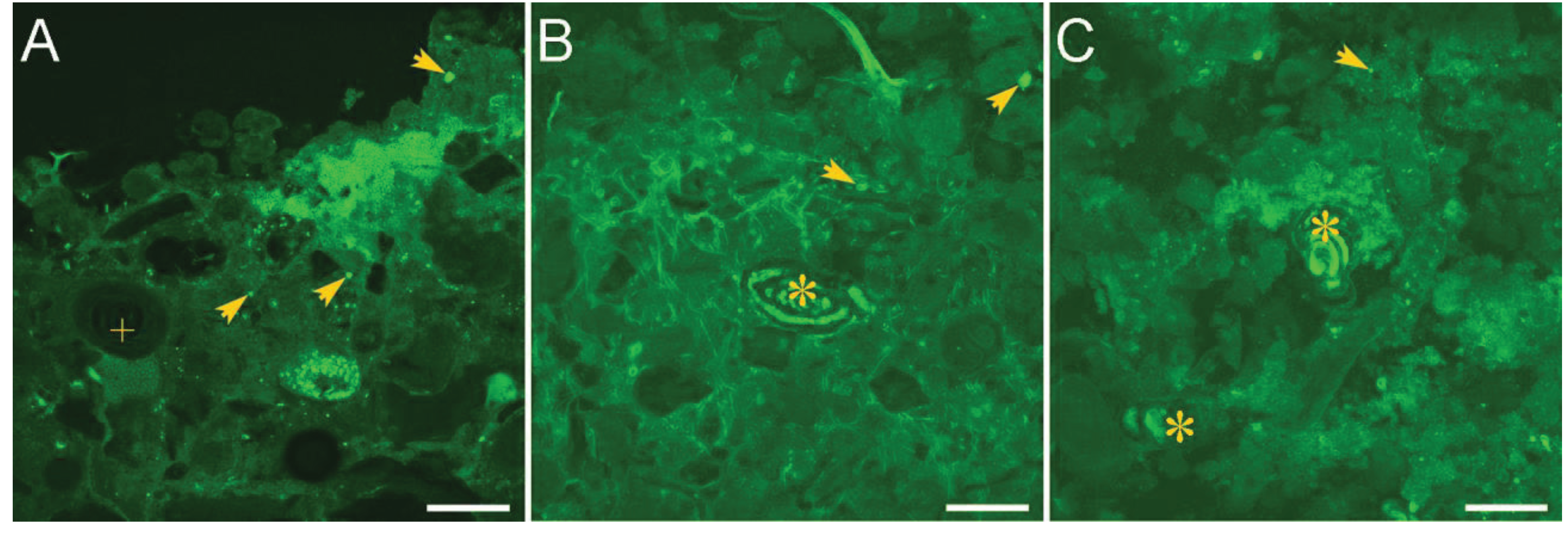 Life Free FullText Heterotrophic Protists in Hypersaline Microbial