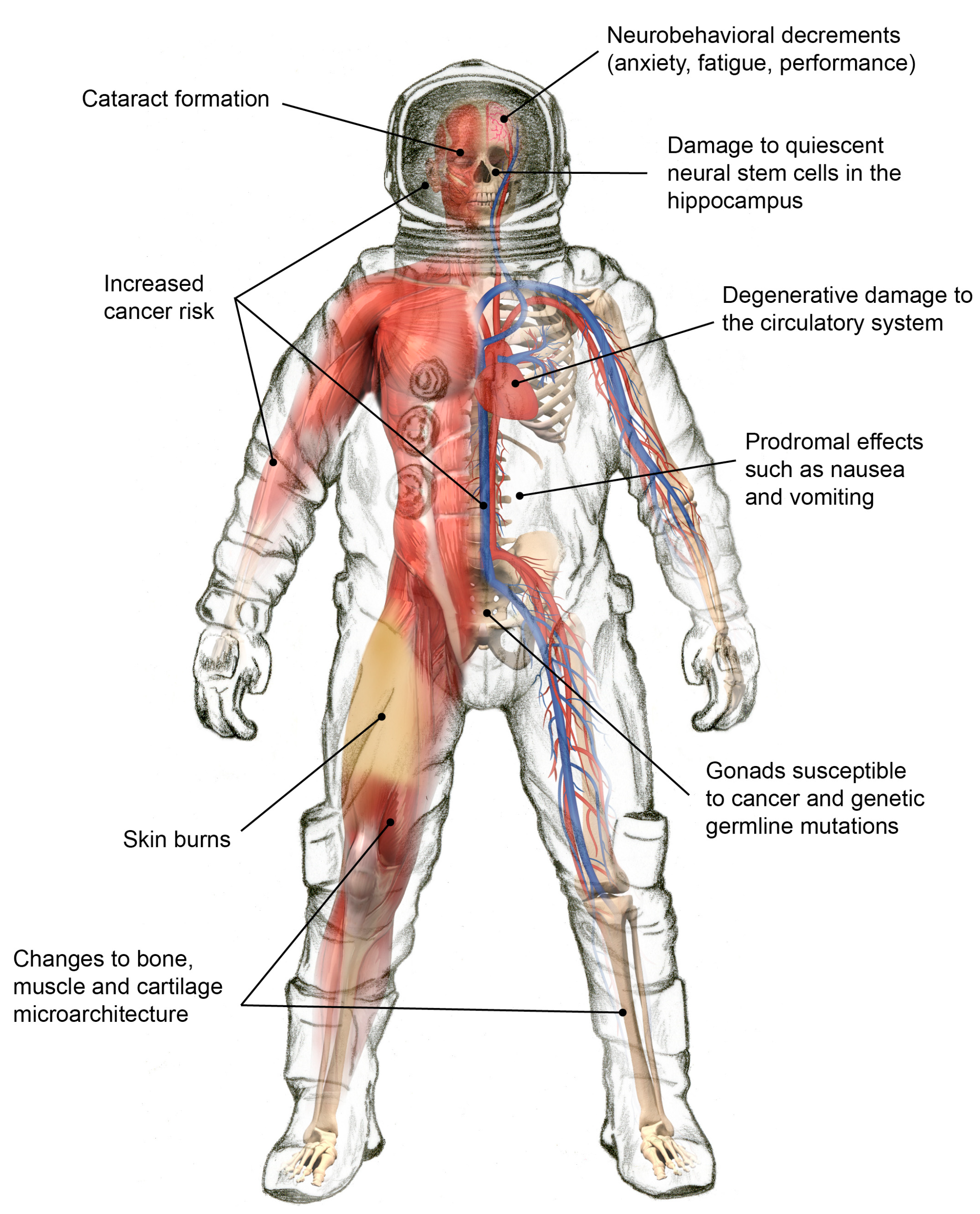 Life Free FullText Space Radiation The Number One Risk to