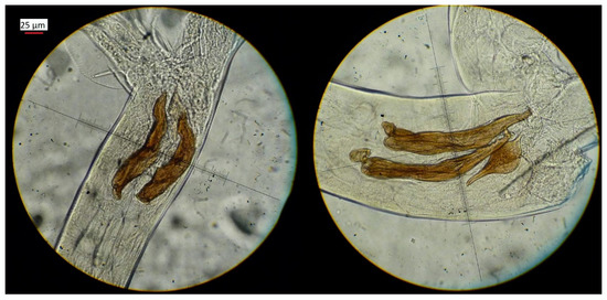 Exotic Species and Autochthonous Parasites: Trichostrongylus