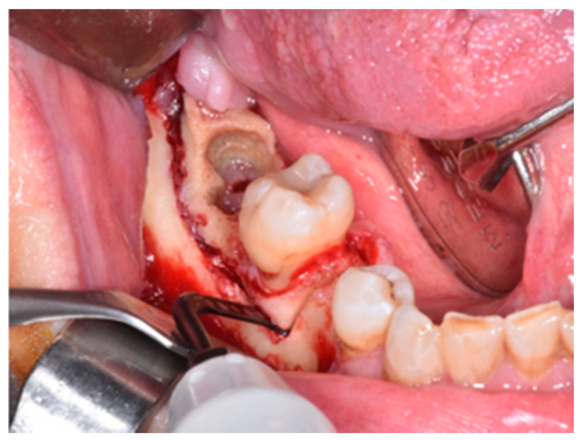 Life 10 00099 g003 Life 10 00099 g003