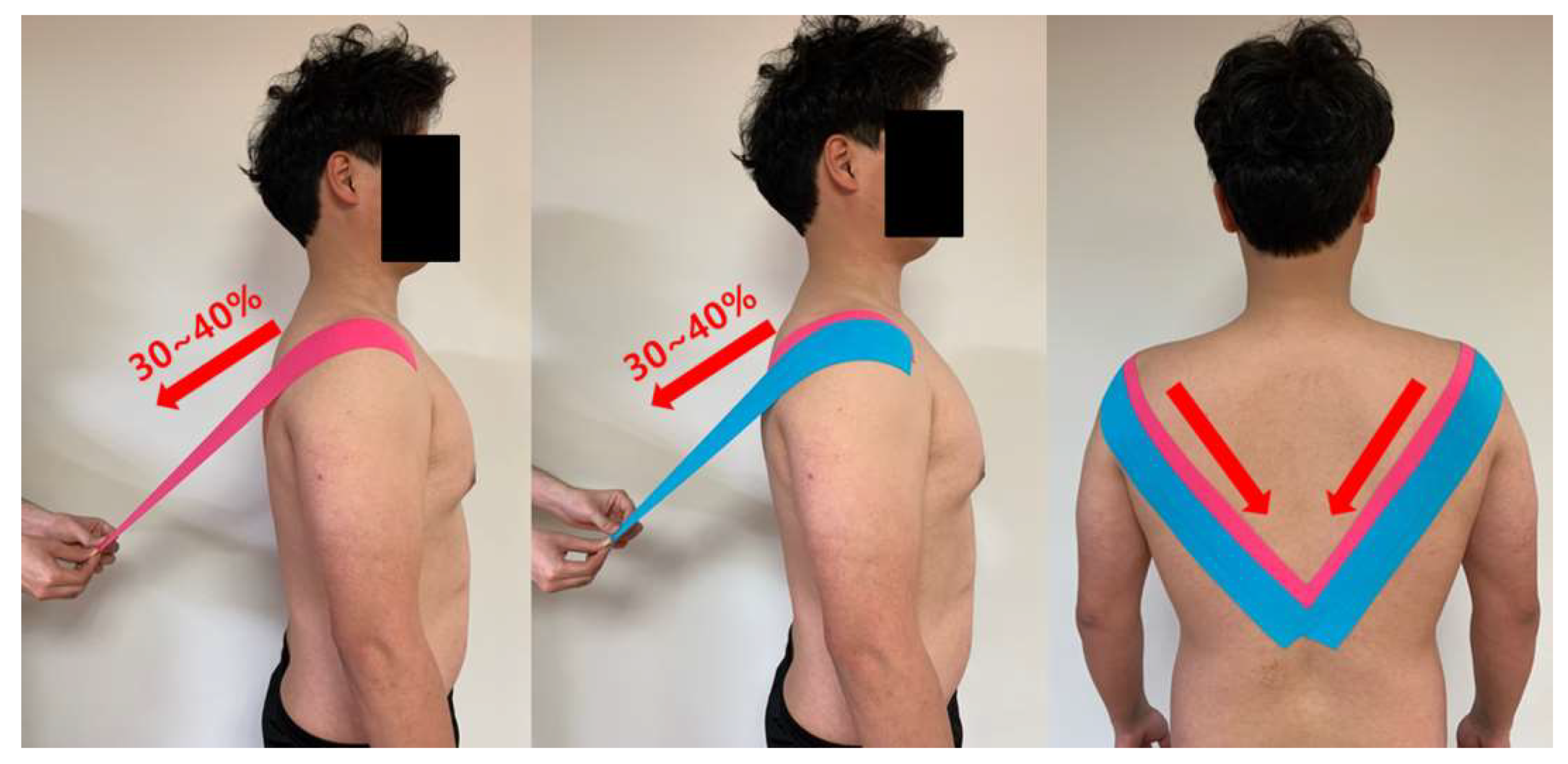 Statistikker fe næve Life | Free Full-Text | Effects of Kinesiology Taping on Shoulder Posture  and Peak Torque in Junior Baseball Players with Rounded Shoulder Posture: A  Pilot Study