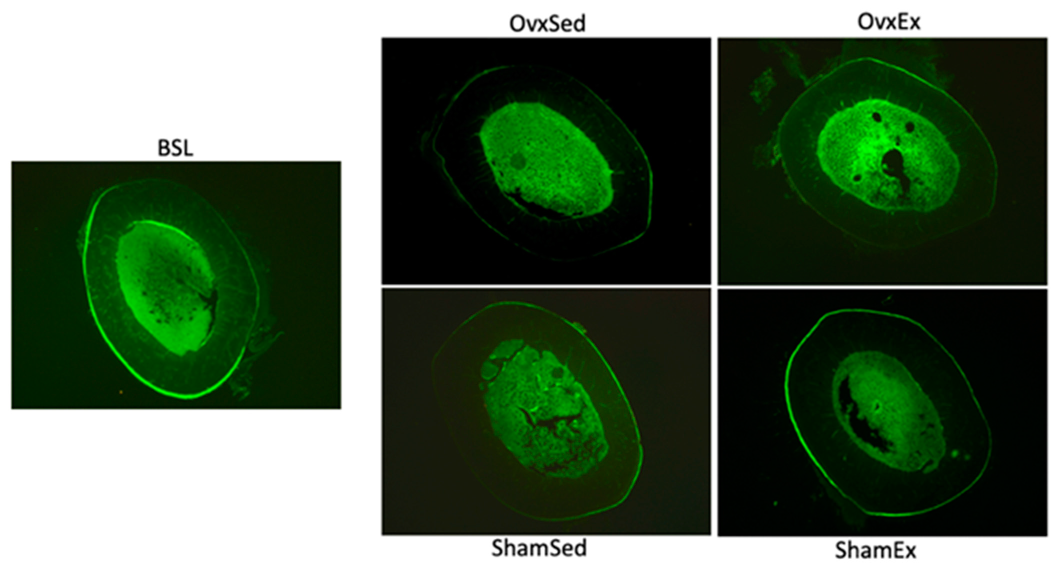 Life Free Full Text Association Between Visceral And Bone Marrow Adipose Tissue And Bone Quality In Sedentary And Physically Active Ovariectomized Wistar Rats Html