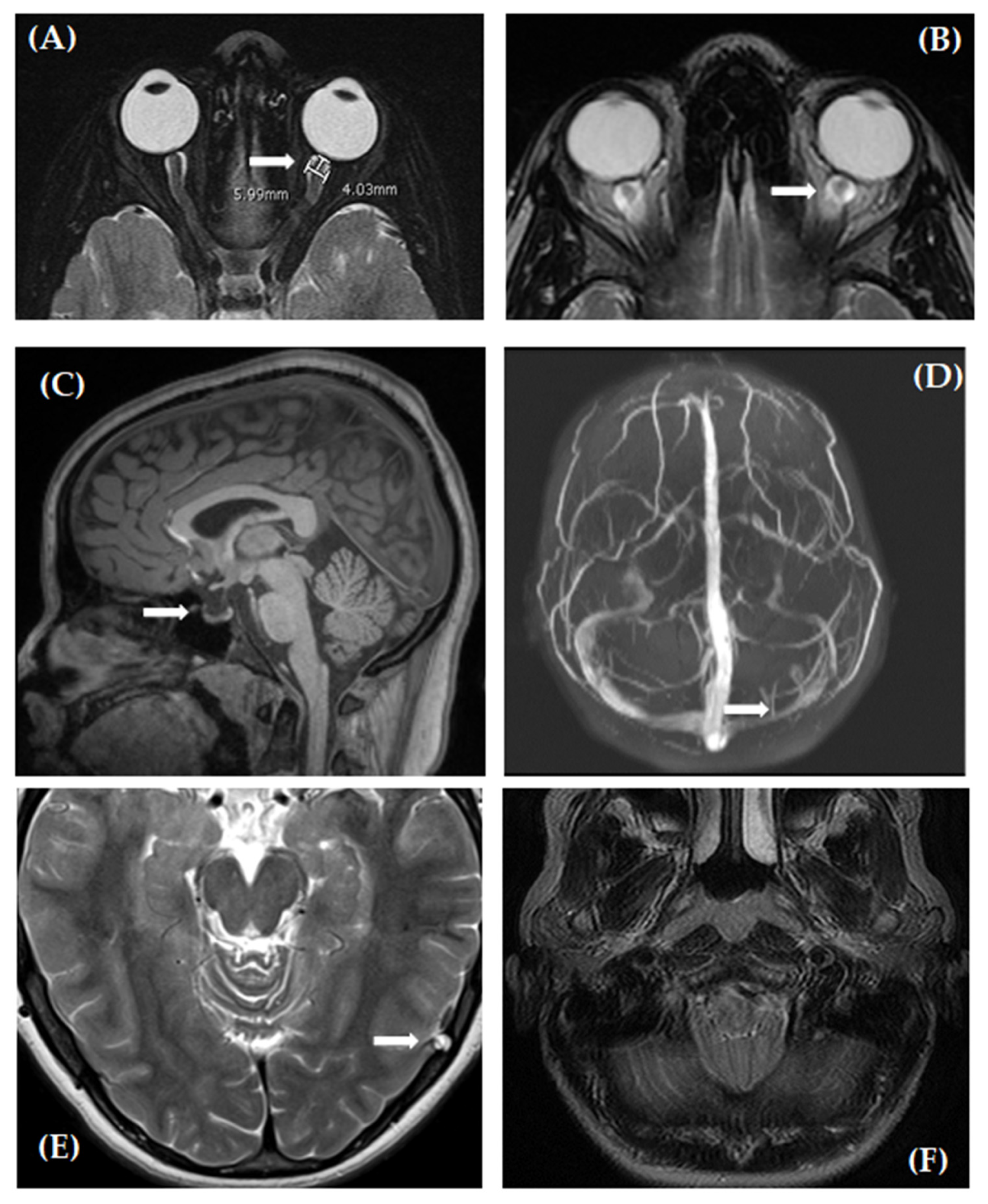 Life 11 00487 g001 Life 11 00487 g001