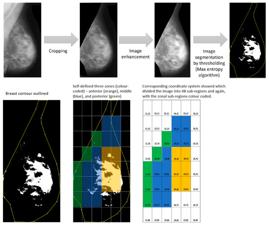 Spatial Distribution and Quantification of Mammographic Breast Density ...
