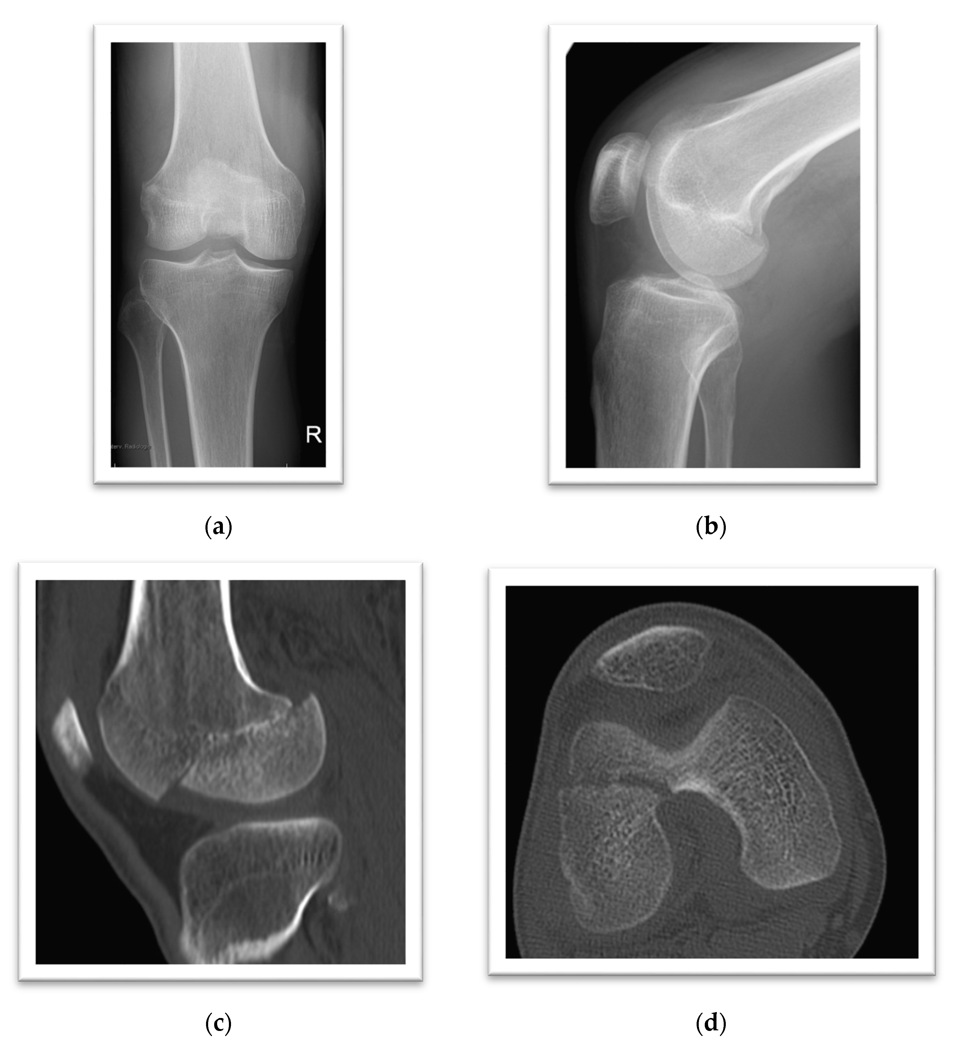 hát ízületi kezelés legjobb kenőcsök a térdízület arthrosisára