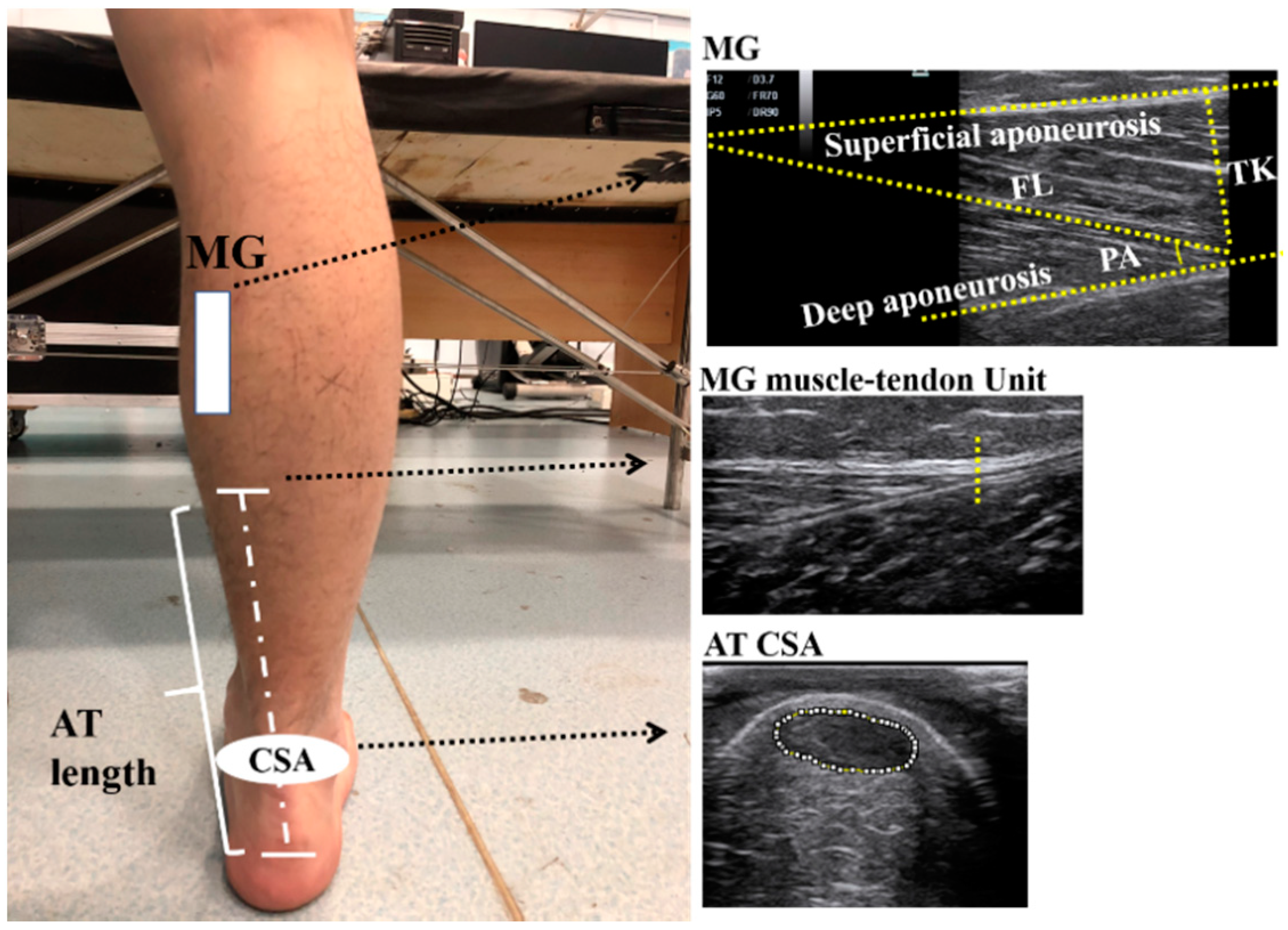 Life Free Full-Text Gender Difference in Architectural and Mechanical Properties of Medial Gastrocnemius–Achilles Tendon Unit In Vivo photo