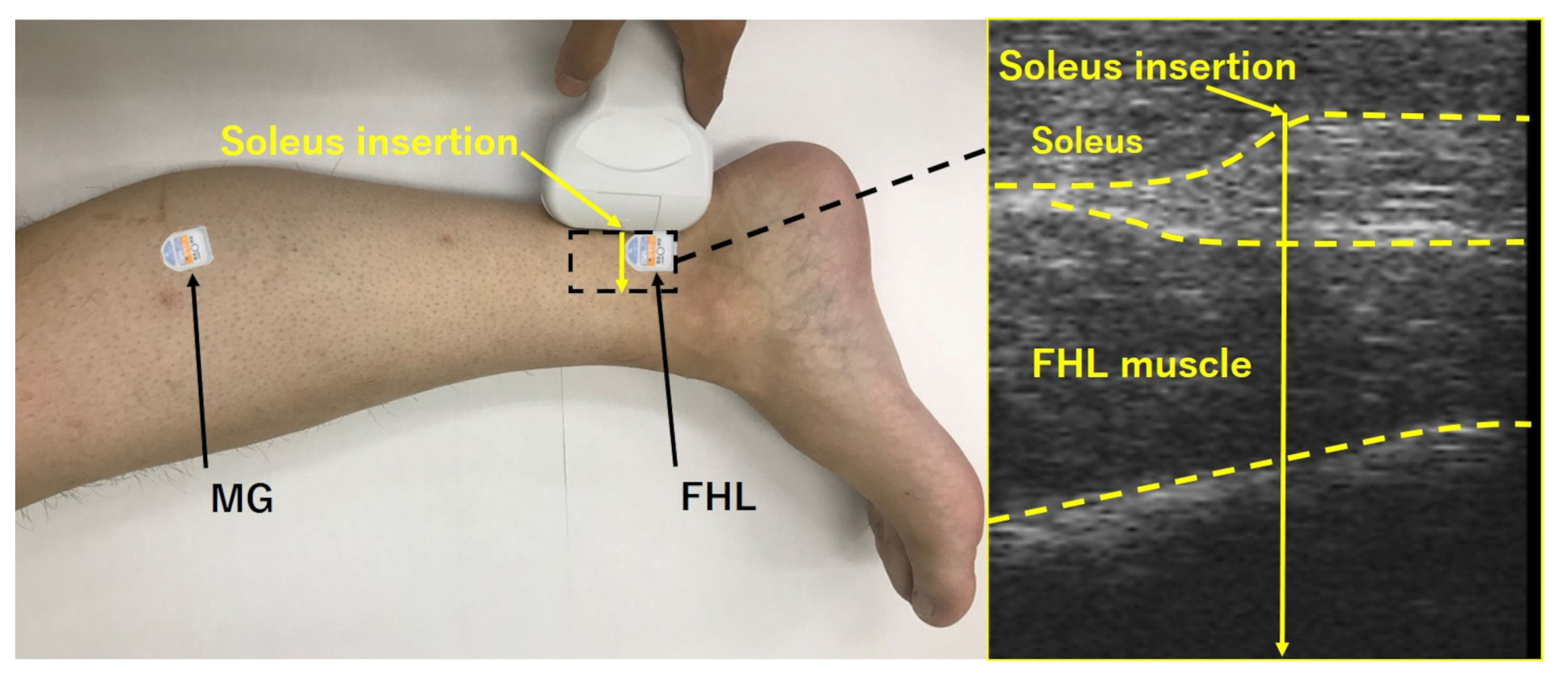Life Free Full Text Effect Of Increased Flexor Hallucis Longus Muscle Activity On Ground Reaction Force During Landing Html Life Free Full Text Effect Of Increased Flexor Hallucis Longus Muscle Activity On Ground Reaction Force During Landing Html