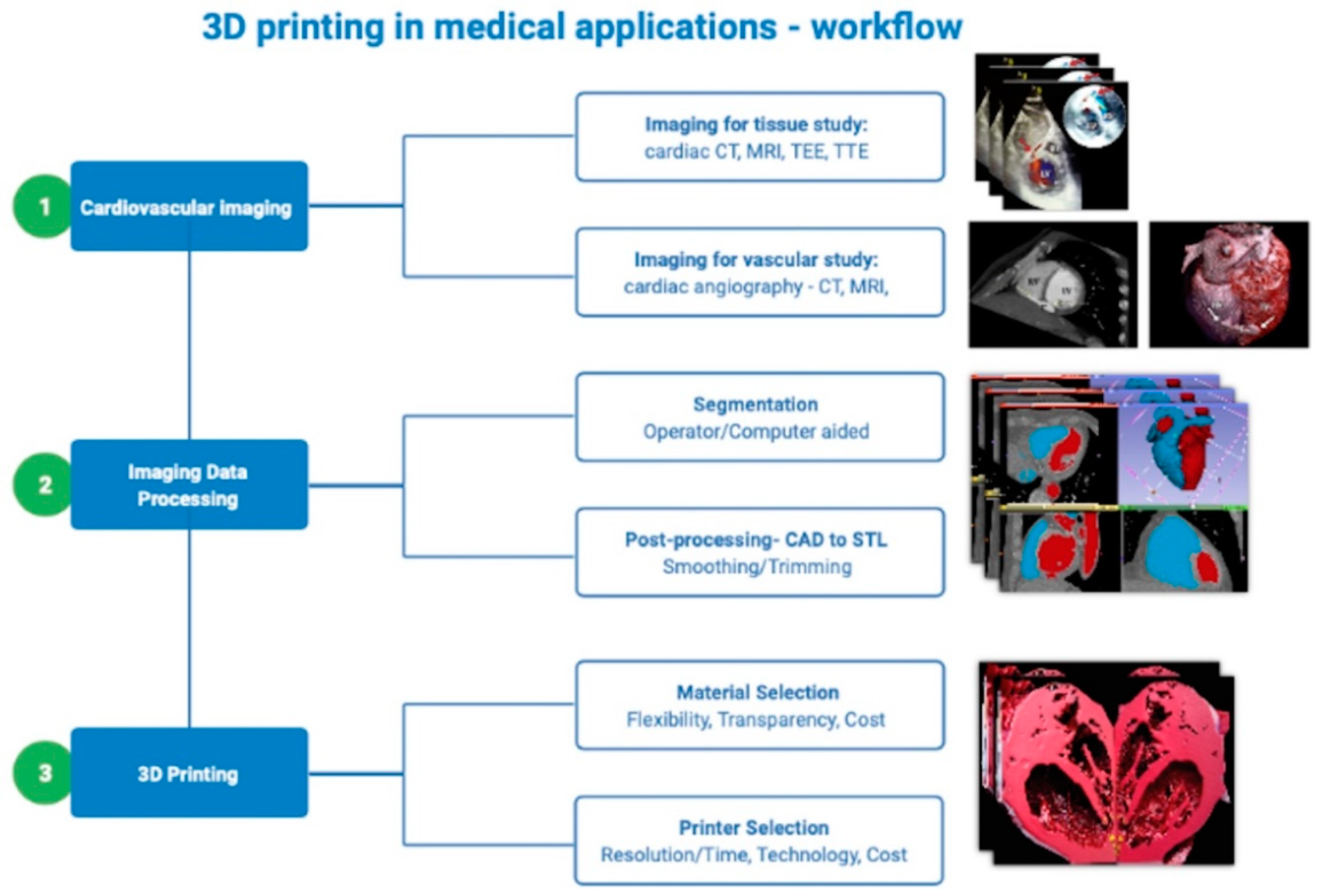 Life | Free Full-Text | 3D Printing—A Cutting Edge for Treating Post-Infarction Patients